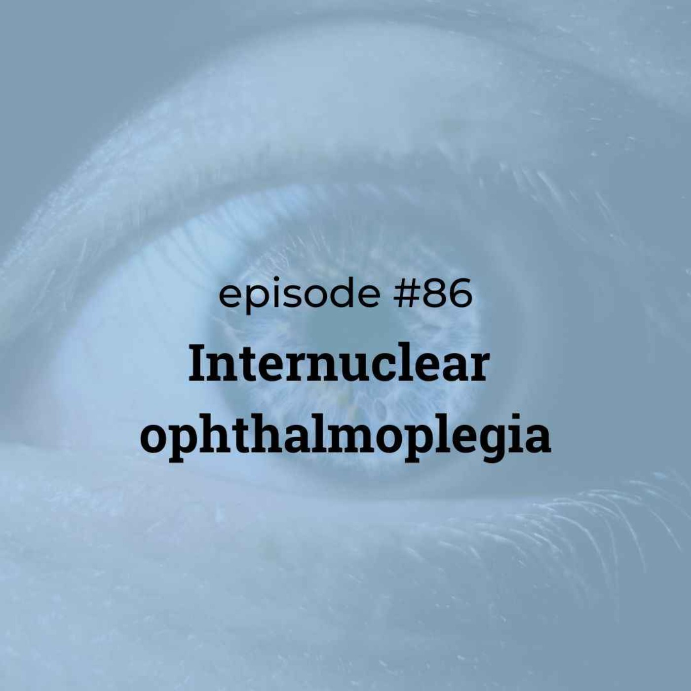 #86 Internuclear ophthalmoplegia