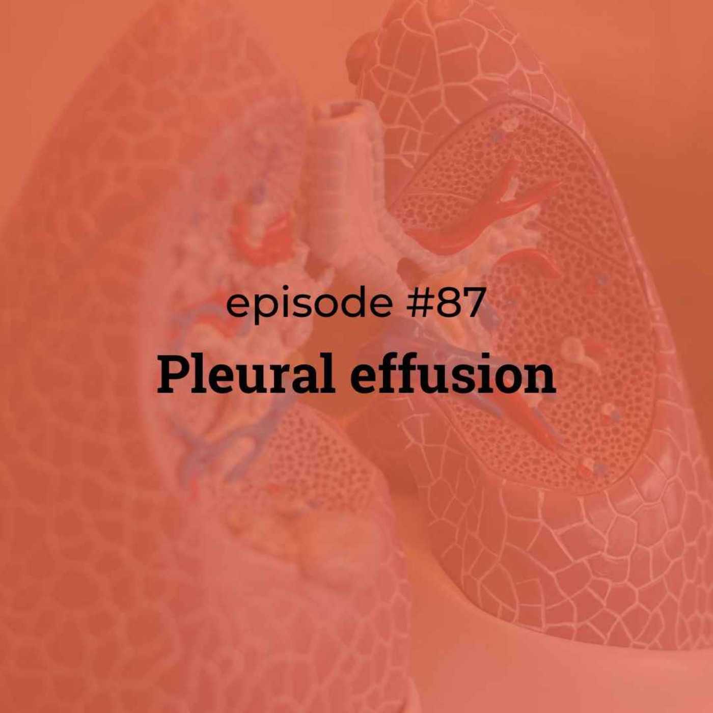 #87 Pleural effusion