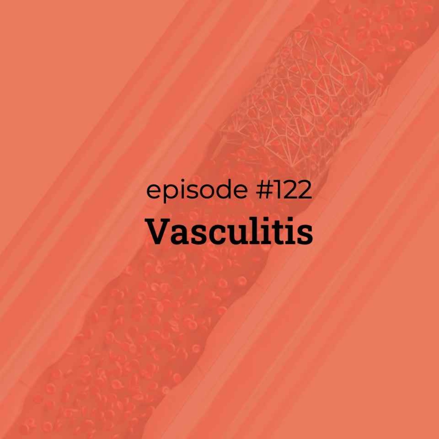 #122 Vasculitis #122 Vasculitis