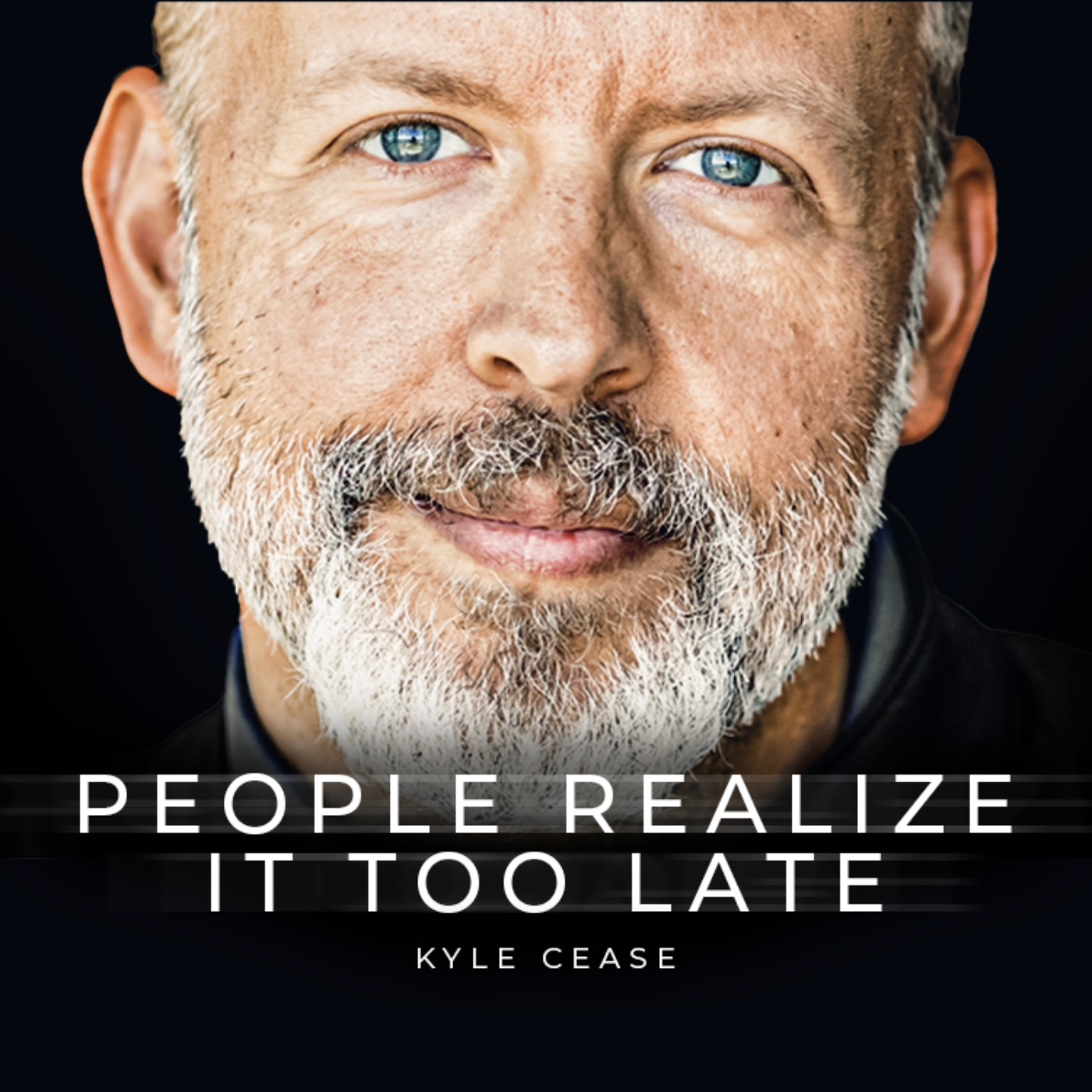 People Realize It Too Late - Kyle Cease’s Powerful Life Message