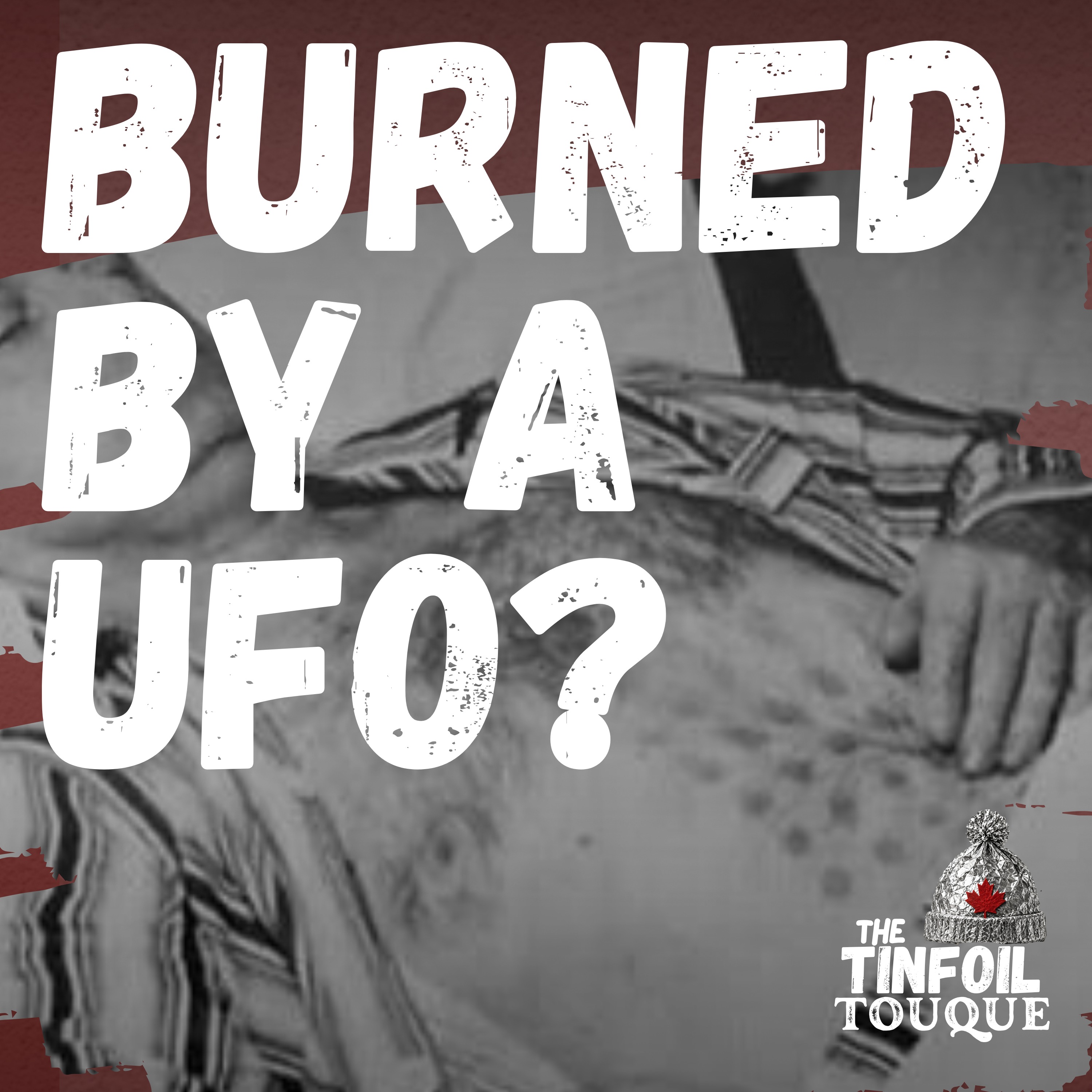 Burned by a UFO? The Falcon Lake Incident