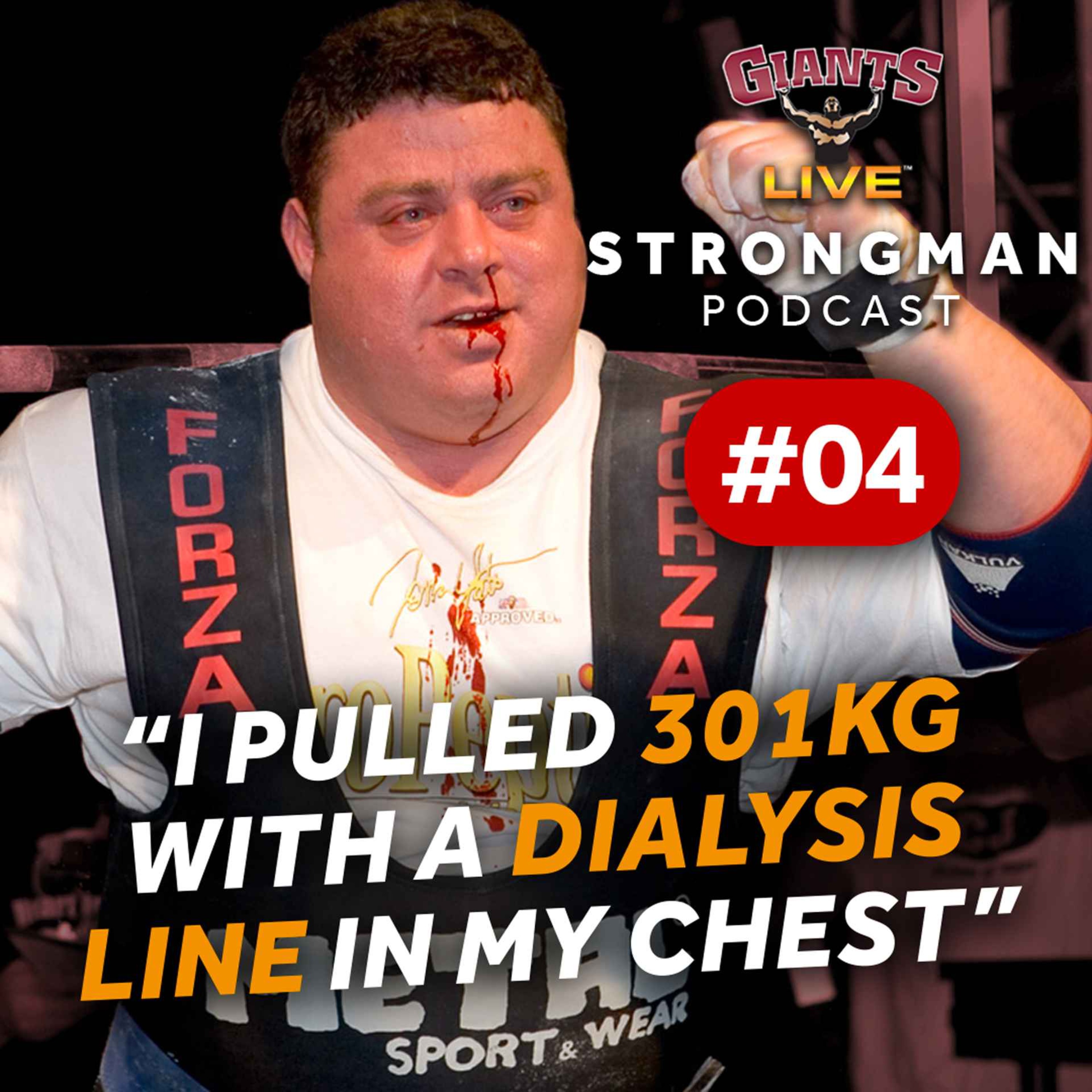 cover art for “I pulled 301KG with a dialysis line in my chest” - Andy Bolton