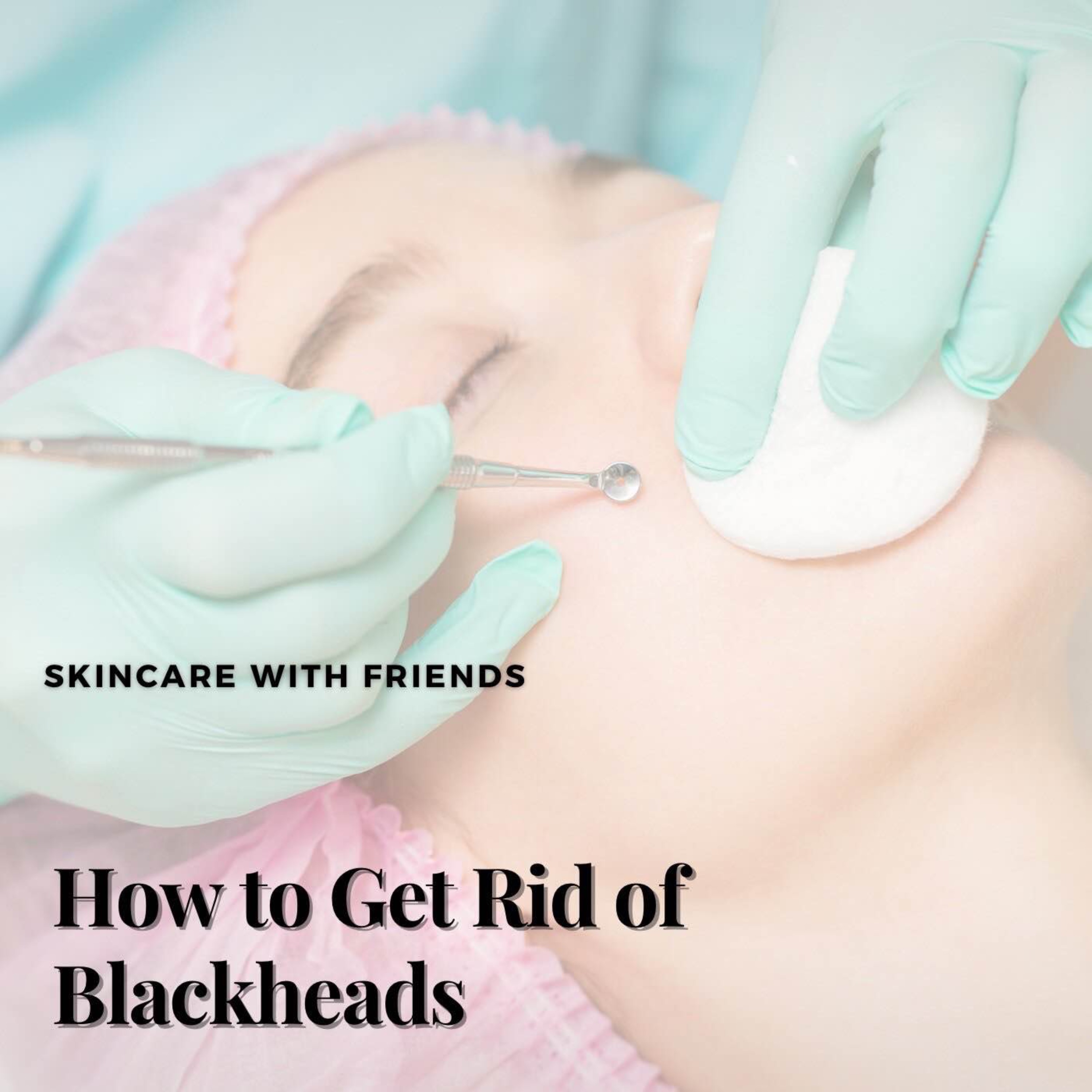 cover art for 80. How to Get Rid of Blackheads