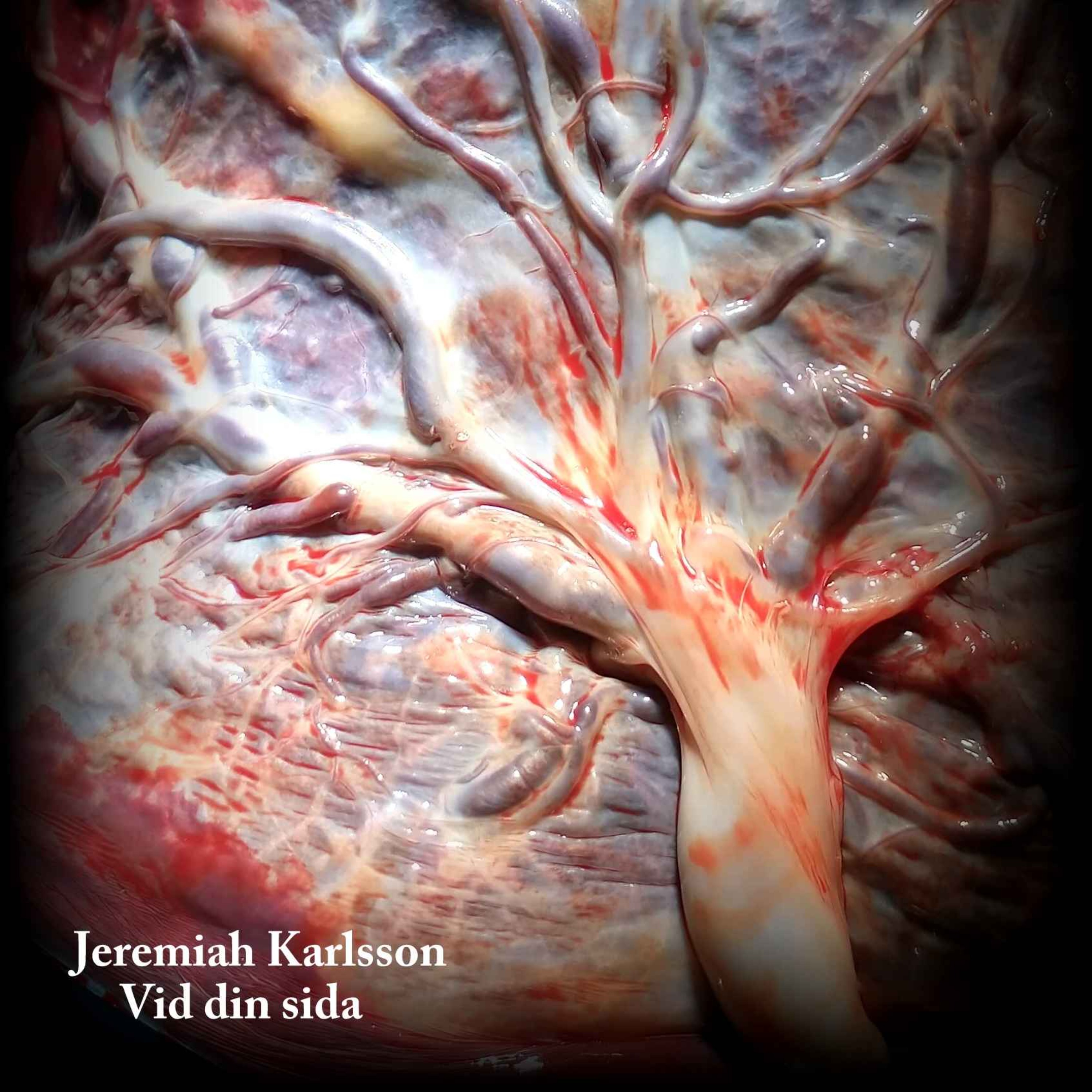 Vid din sida episode artwork