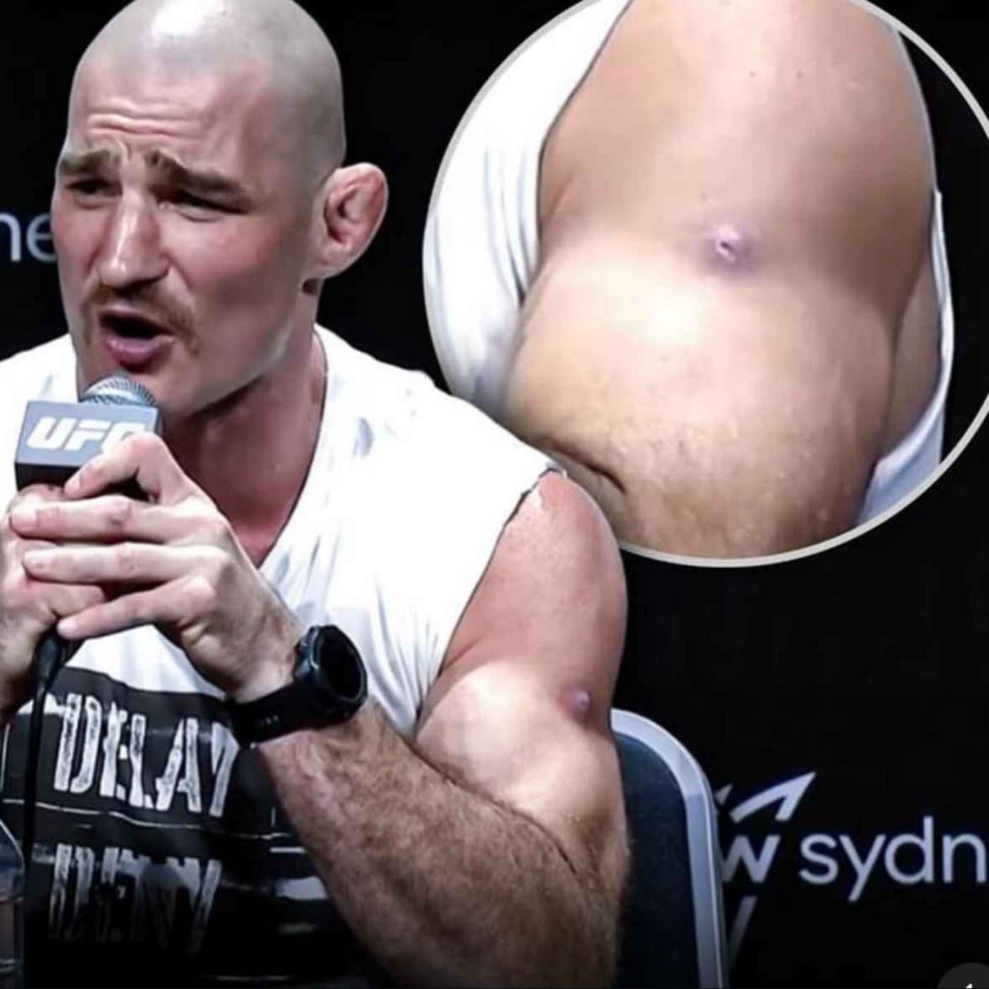#132 Understanding Skin Infections For Combat Sports