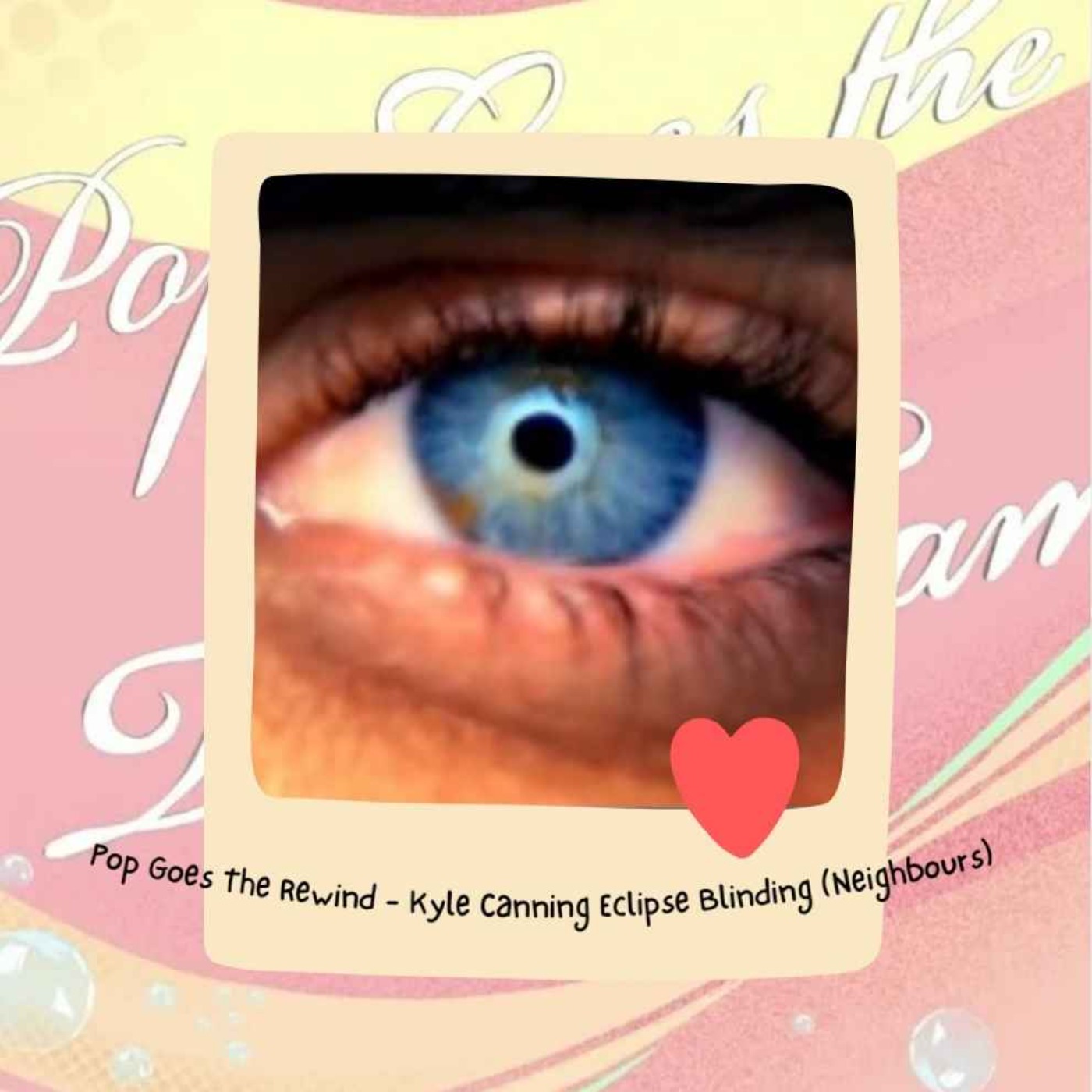 Pop Goes The Rewind - Kyle Canning Eclipse Blinding (Neighbours) episode artwork