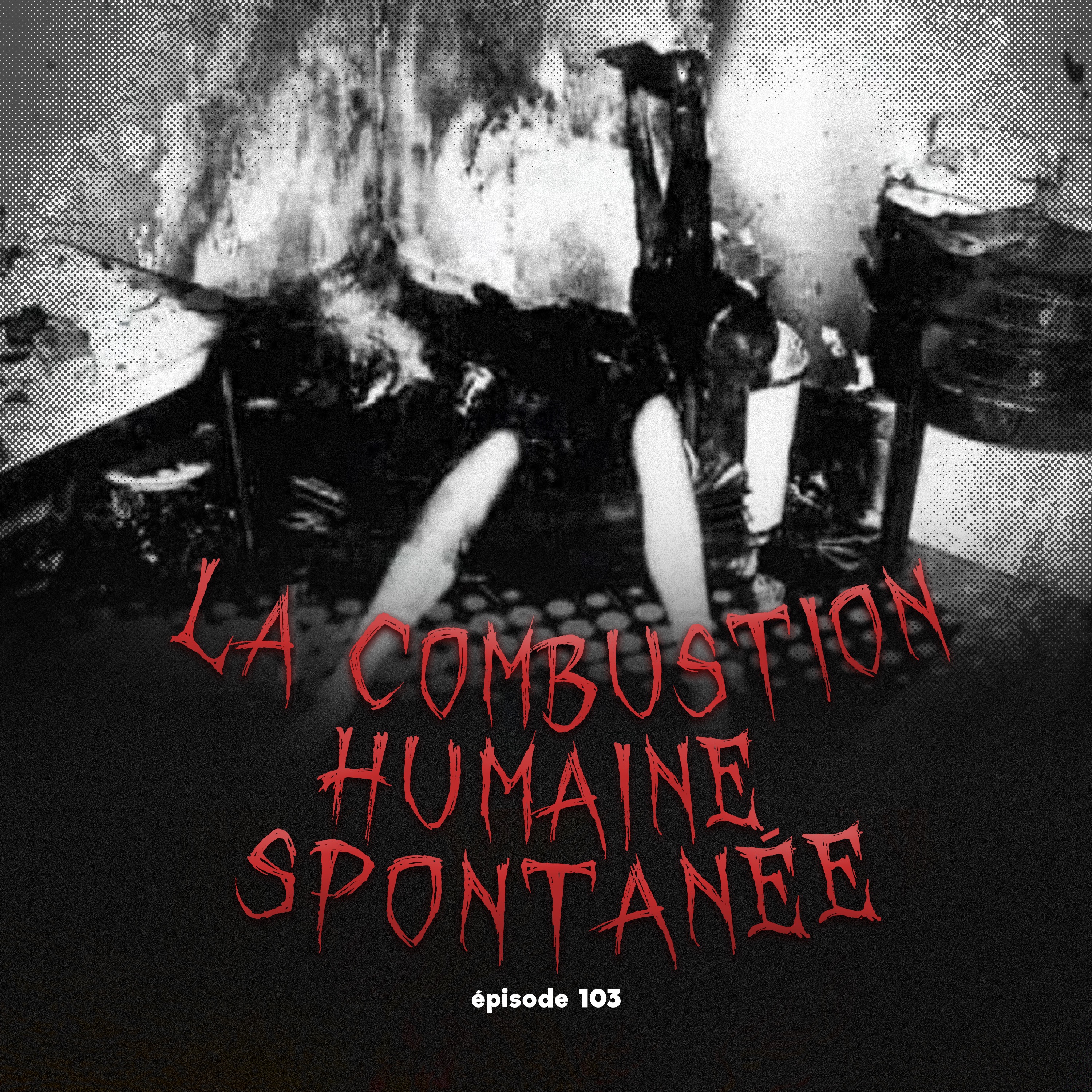 #103 - La Combustion Humaine Spontanée: mythe ou réalité?