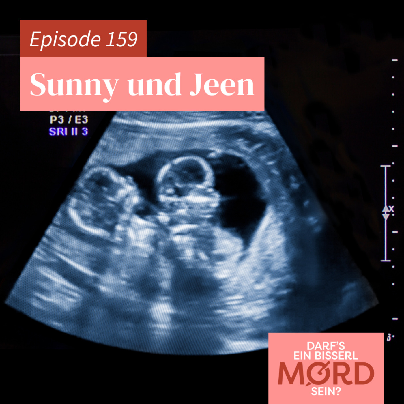 Episode 159: Sunny und Jeen