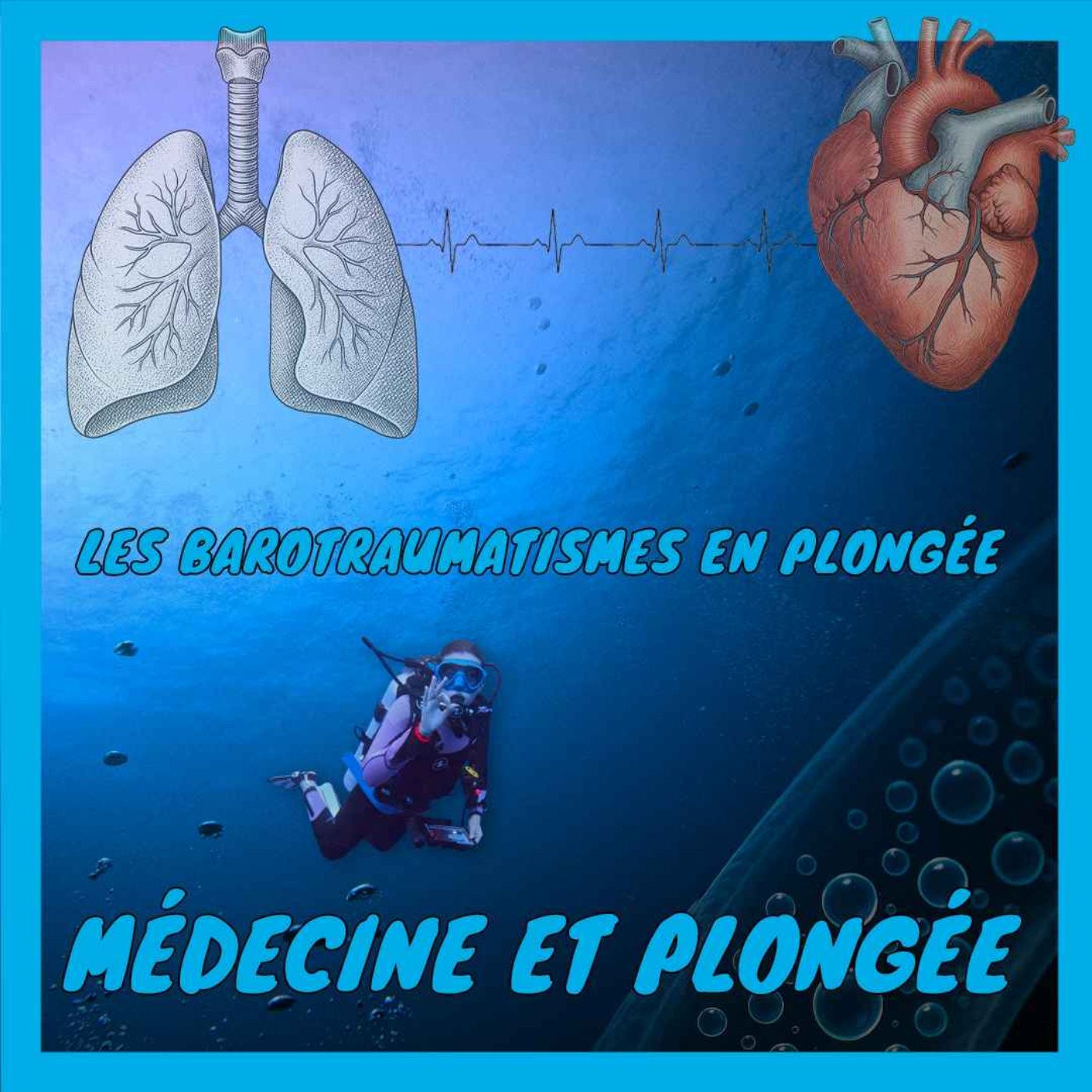 [Médecine et plongée] Les barotraumatismes en plongée