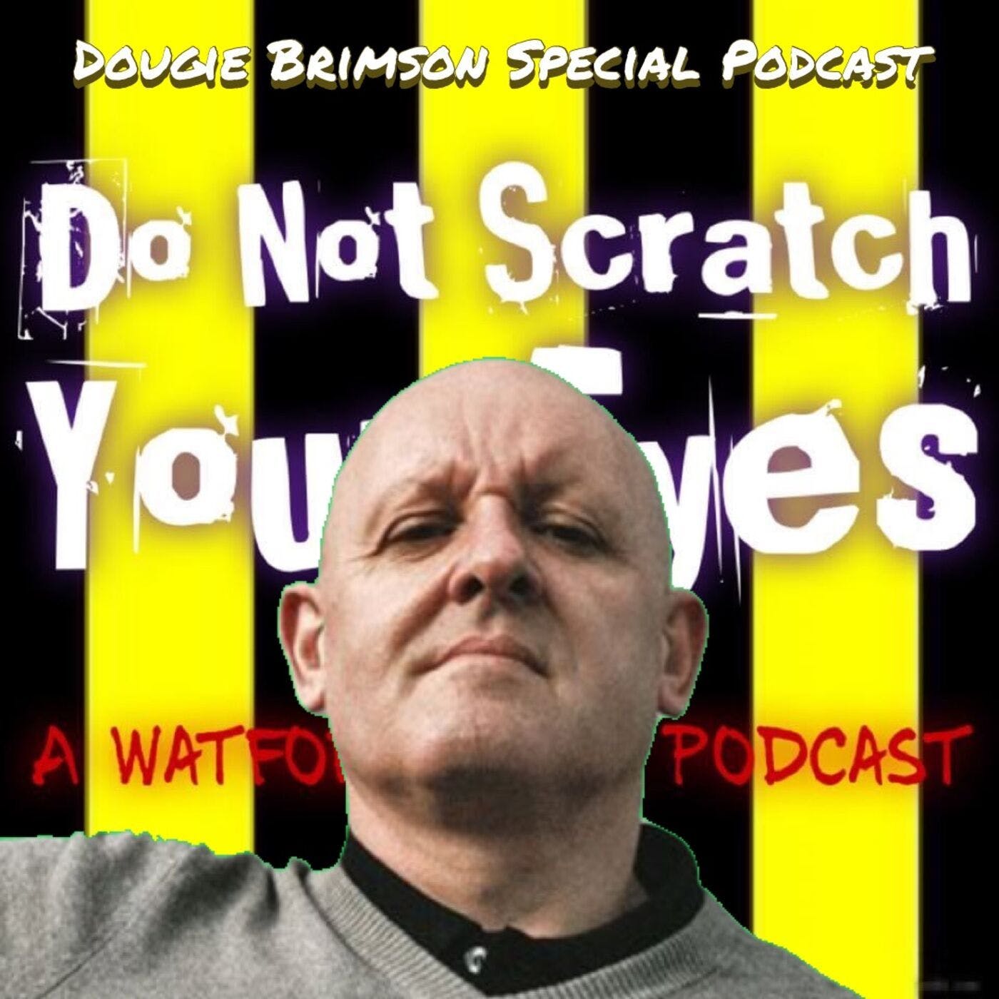 Do Not Scratch Your Eyes - Dougie Brimson Special - S2 Ep19 thumbnail