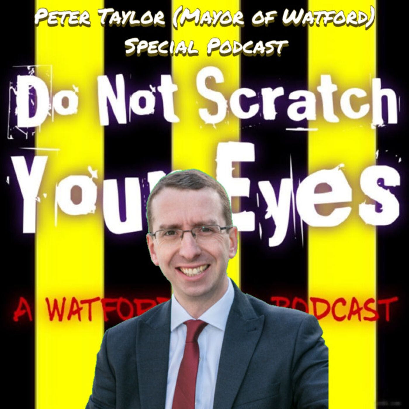 Do Not Scratch Your Eyes - Peter Taylor (Mayor of Watford) Special - S1 Ep41 thumbnail