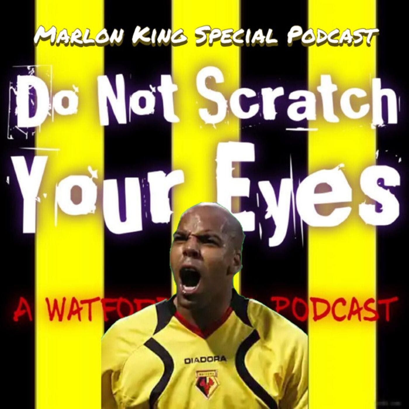 Do Not Scratch Your Eyes - Marlon King Special - S1 Ep32 thumbnail