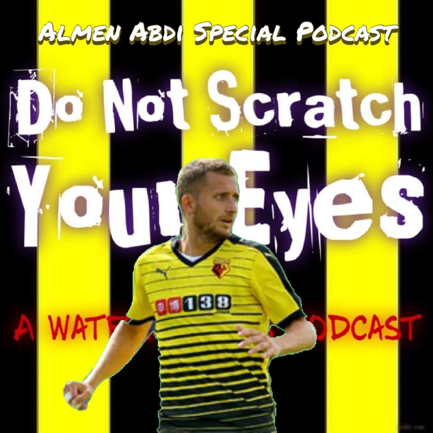 Do Not Scratch Your Eyes - Almen Abdi Special - S1 Ep31 thumbnail