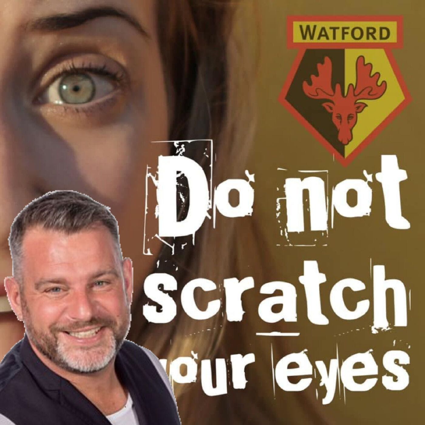 Do Not Scratch Your Eyes - Andy Collins Special - S1 Ep17 thumbnail