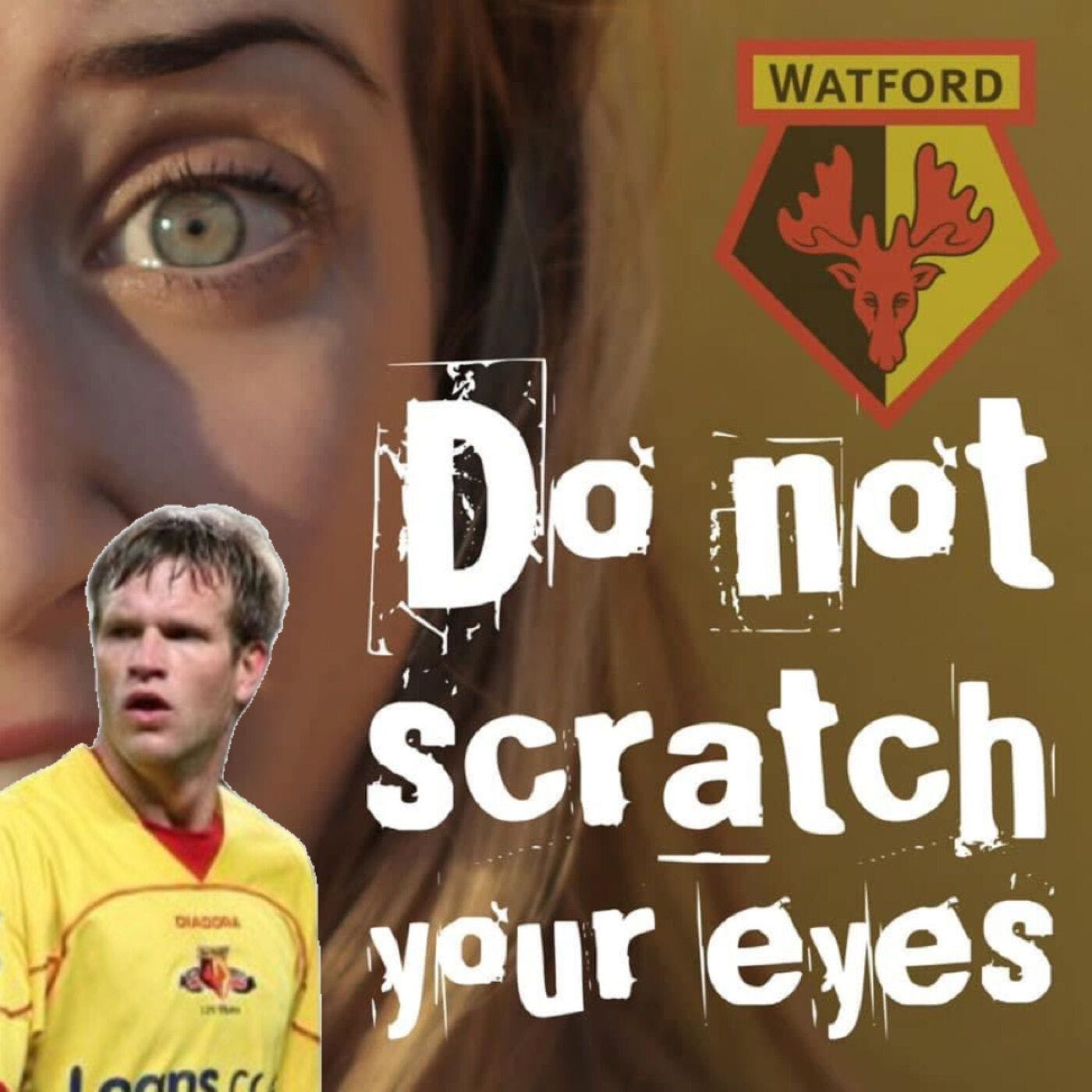 Do Not Scratch Your Eyes - Jay DeMerit Special - S1 Ep12 thumbnail