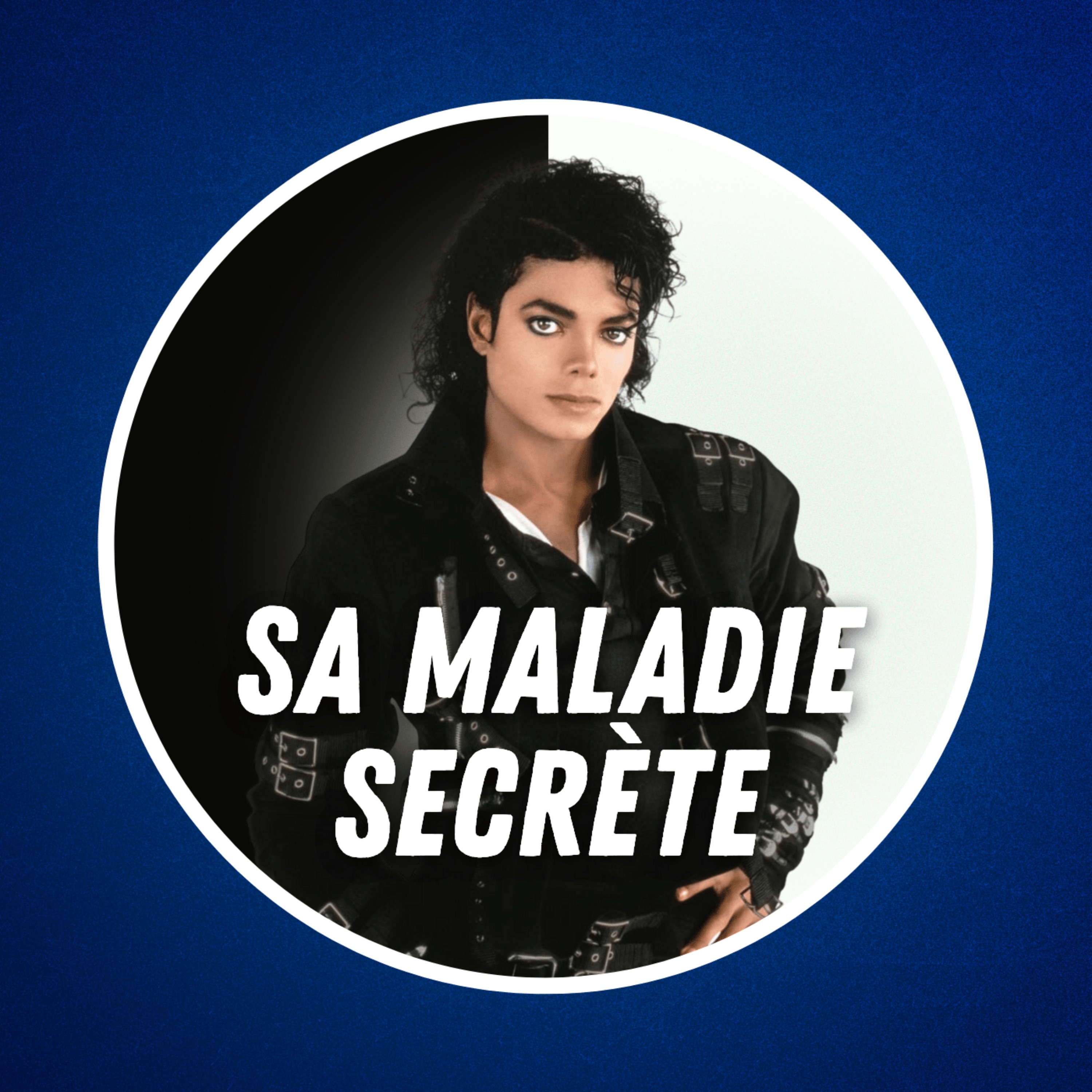 Pourquoi Michael Jackson est-il devenu blanc ? 🪩