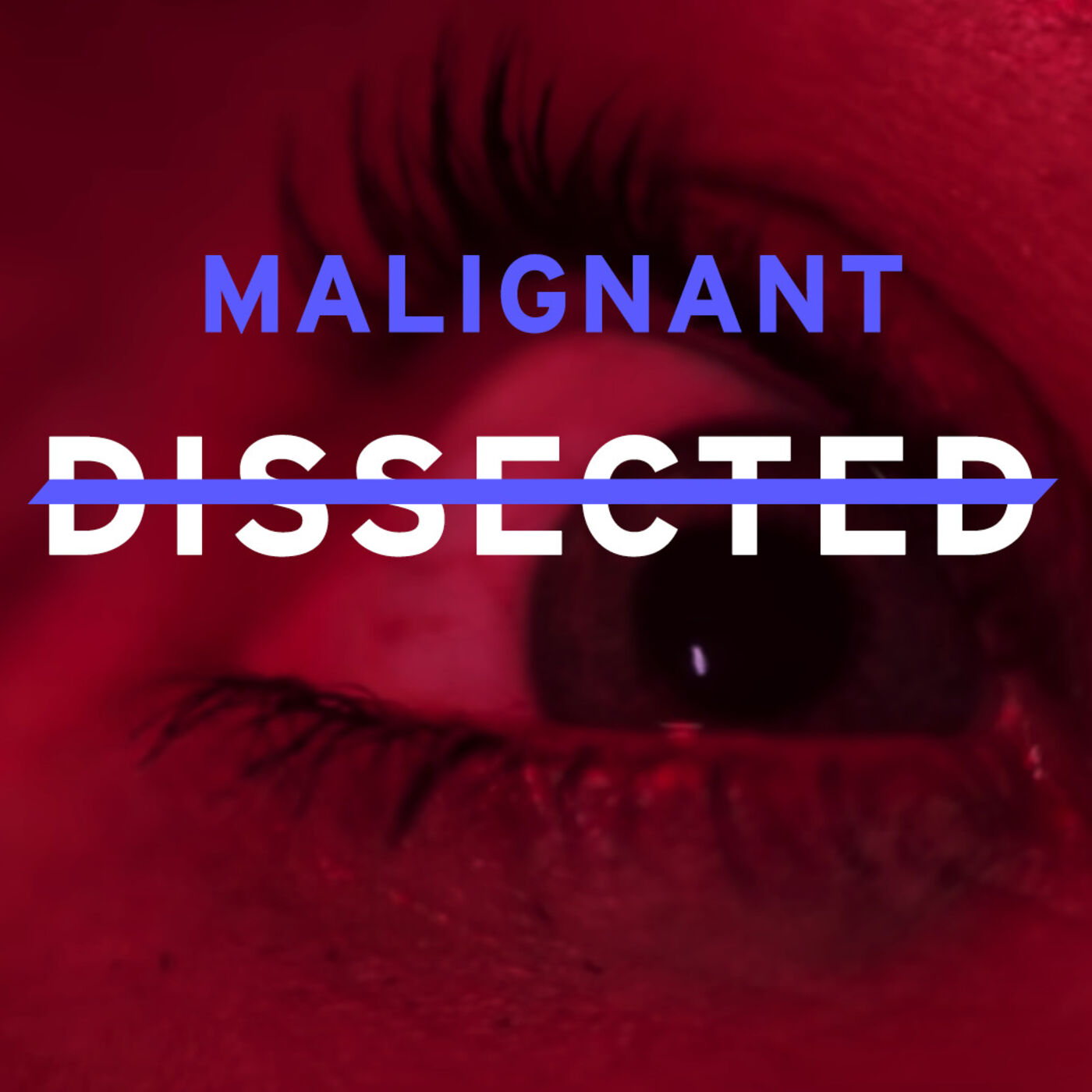Dissected - Ep. 6 : Malignant, c'est dans ta tête