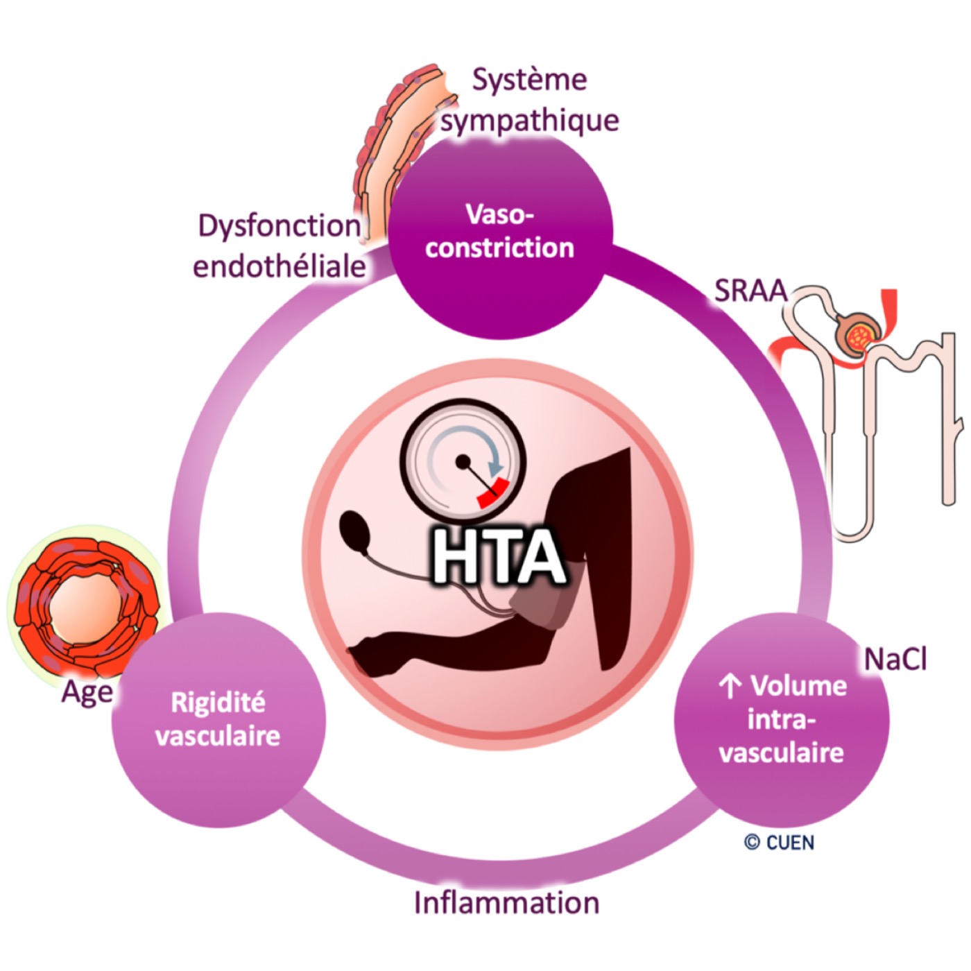 Physiopathologie de l'hypertension artérielle