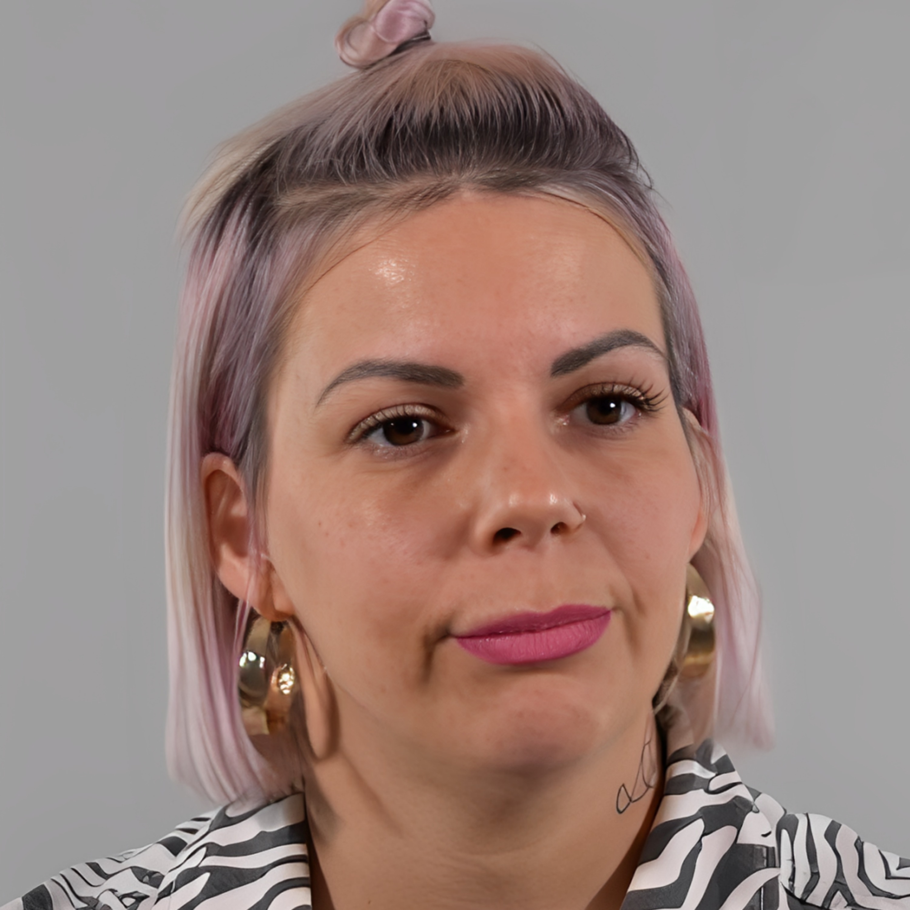 ELLE A RÉUSSI À ACCEPTER SON HANDICAP GRÂCE À LA DANSE