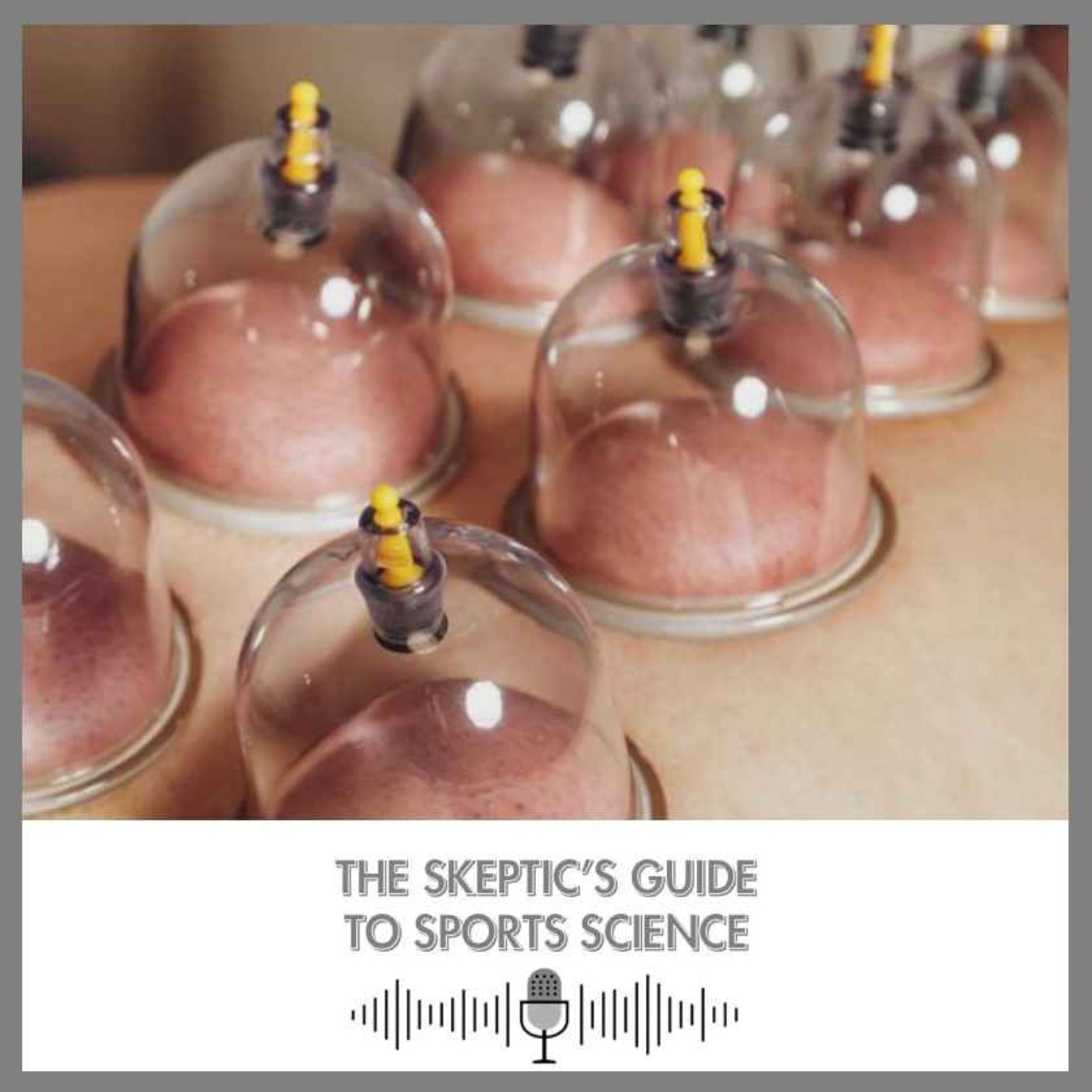25. Phelps Dives Deeper into the Pseudoscience of Cupping