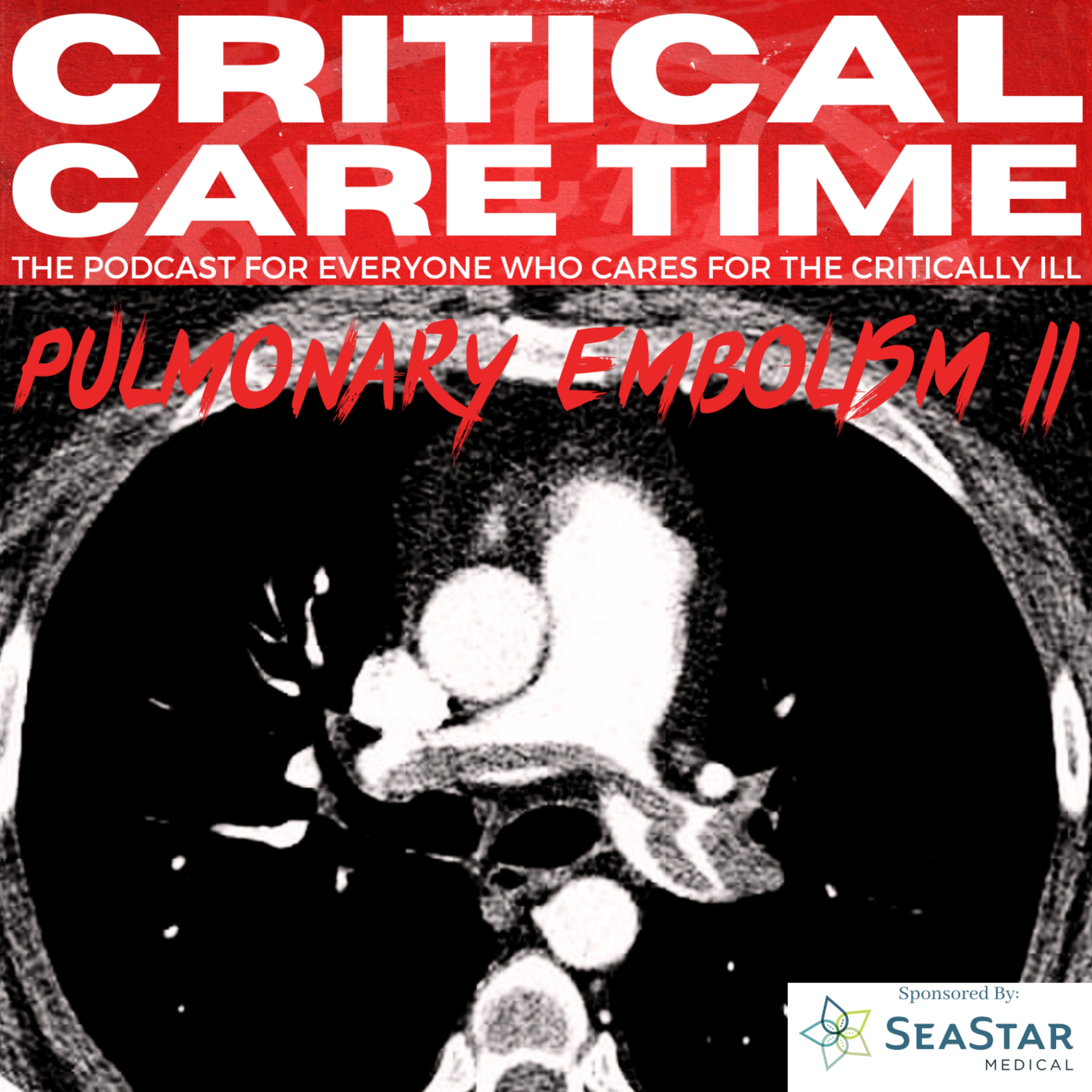 cover art for 16. Pulmonary Embolism Part II