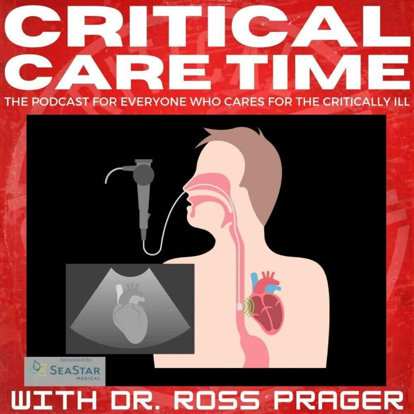 23. Resuscitative TEE with Dr. Ross Prager