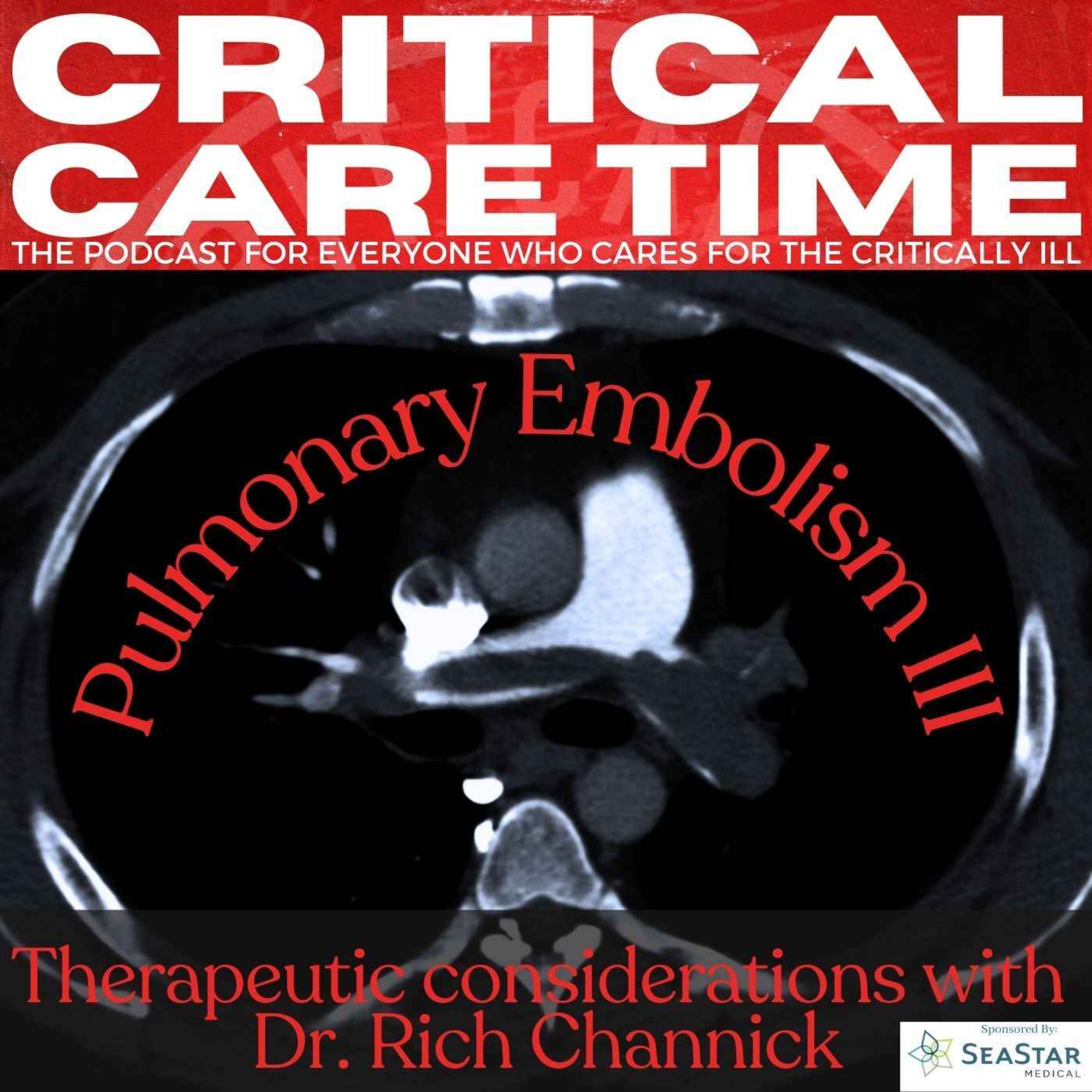 35. Pulmonary Embolism: Part III