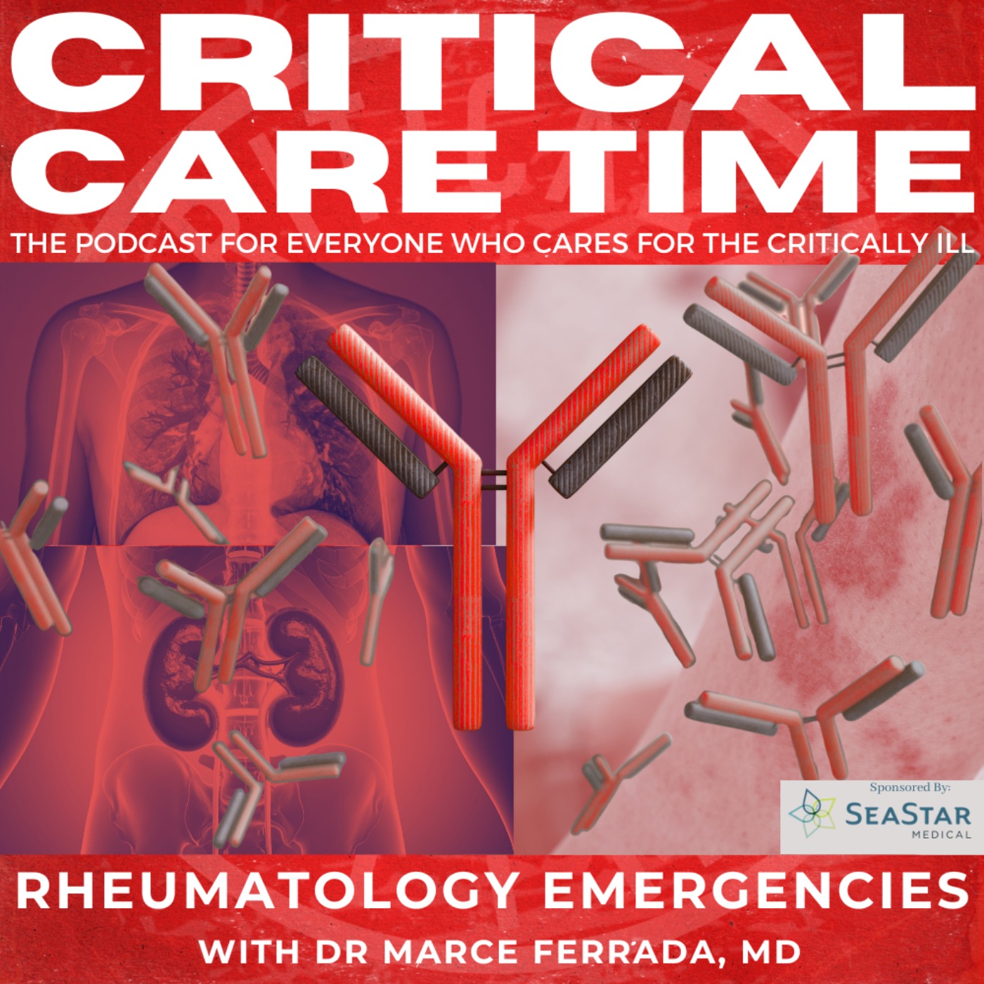66. Rheumatology Emergencies with Dr. Marcela Ferrada