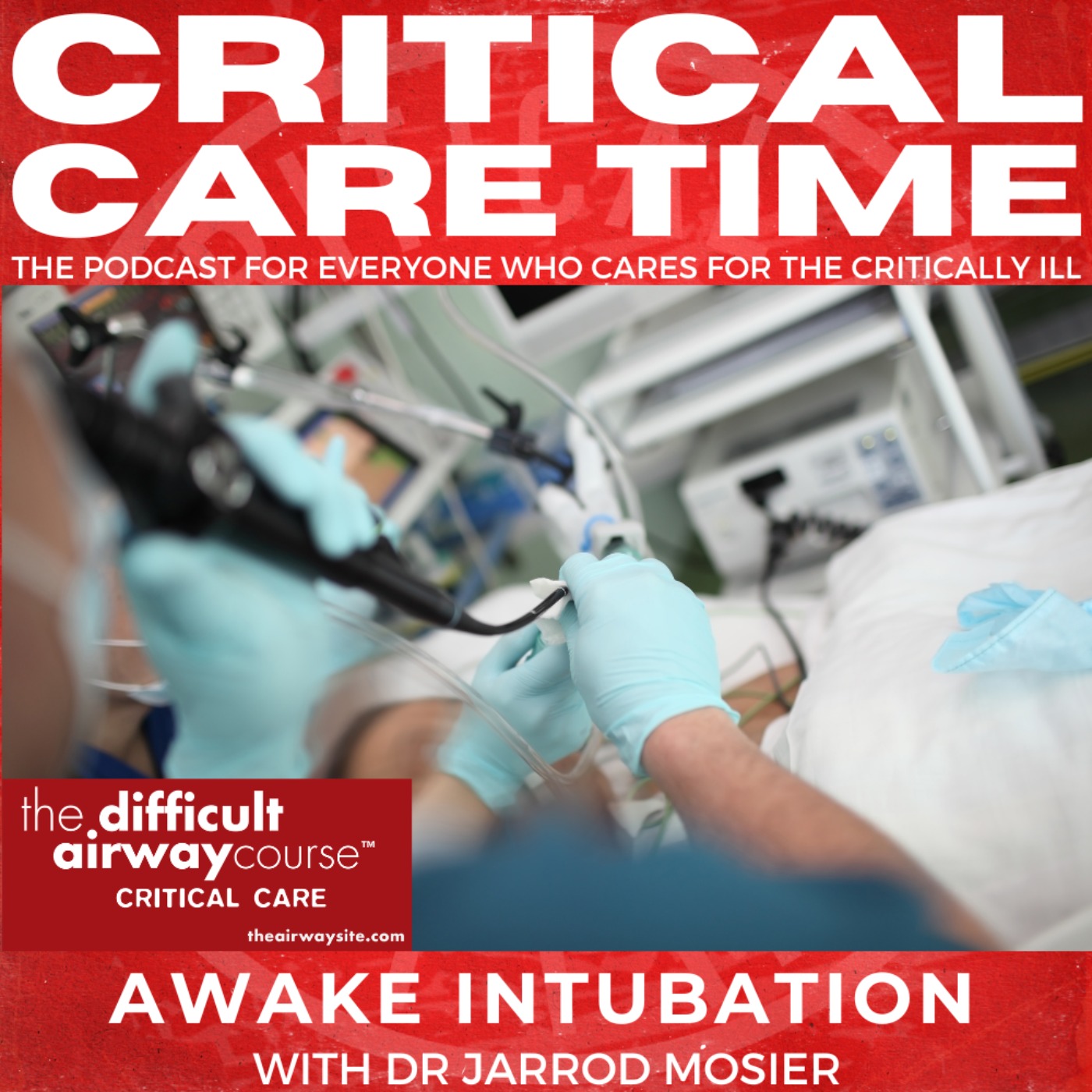 81. Advanced Airway Management & Awake Intubation with Dr. Jarrod Mosier Episode cover
