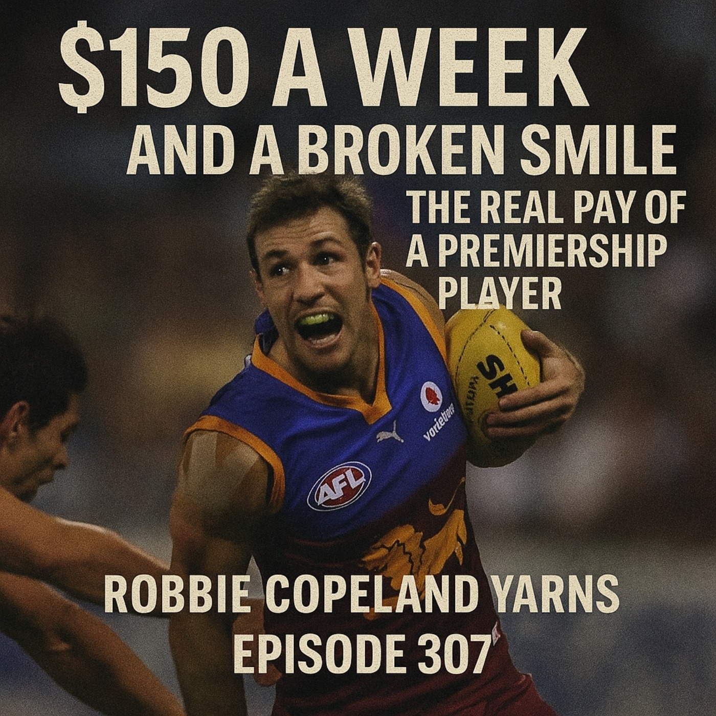 $150 a Week and a Broken Smile – The Real Pay of a Premiership Player