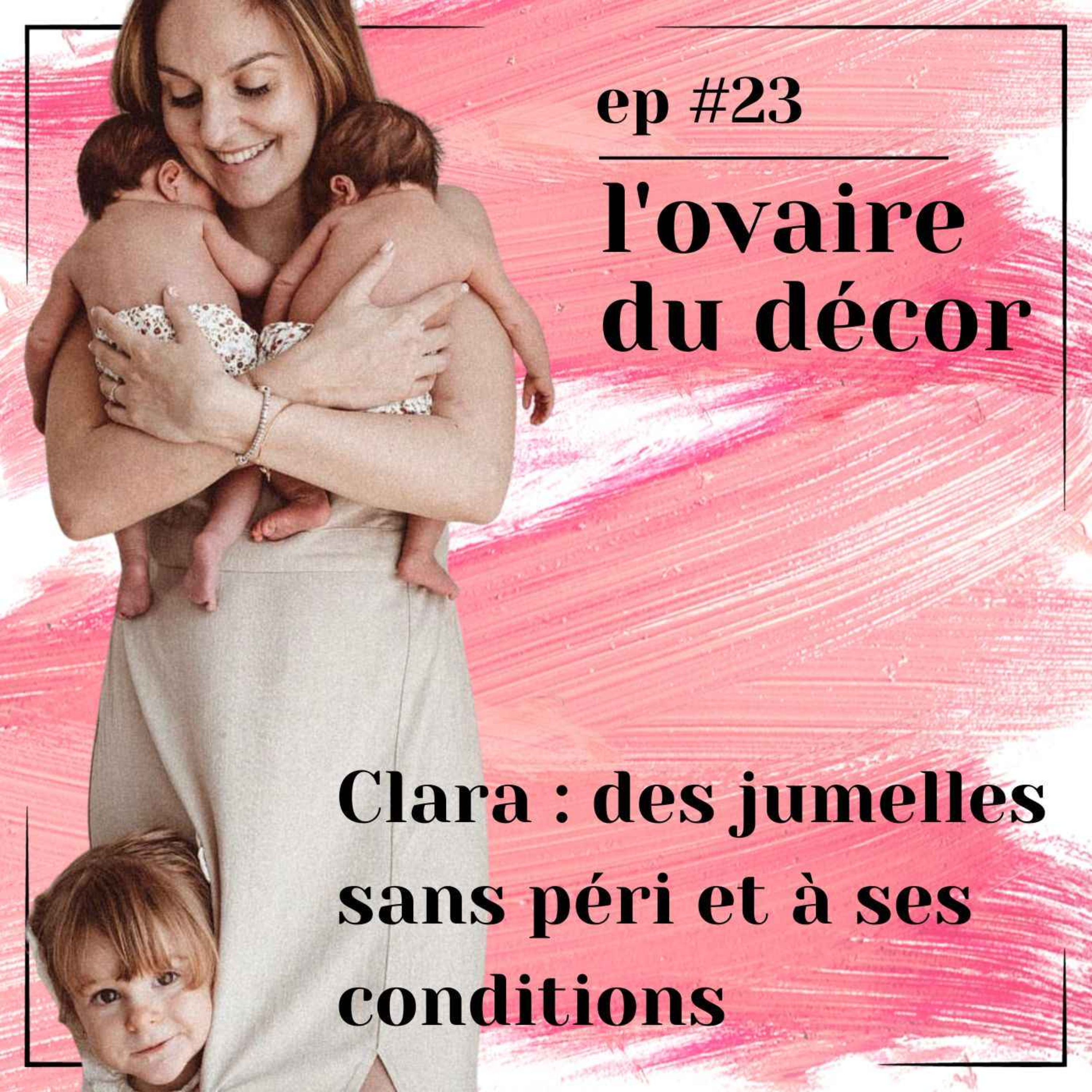 L\'ovaire du décor
