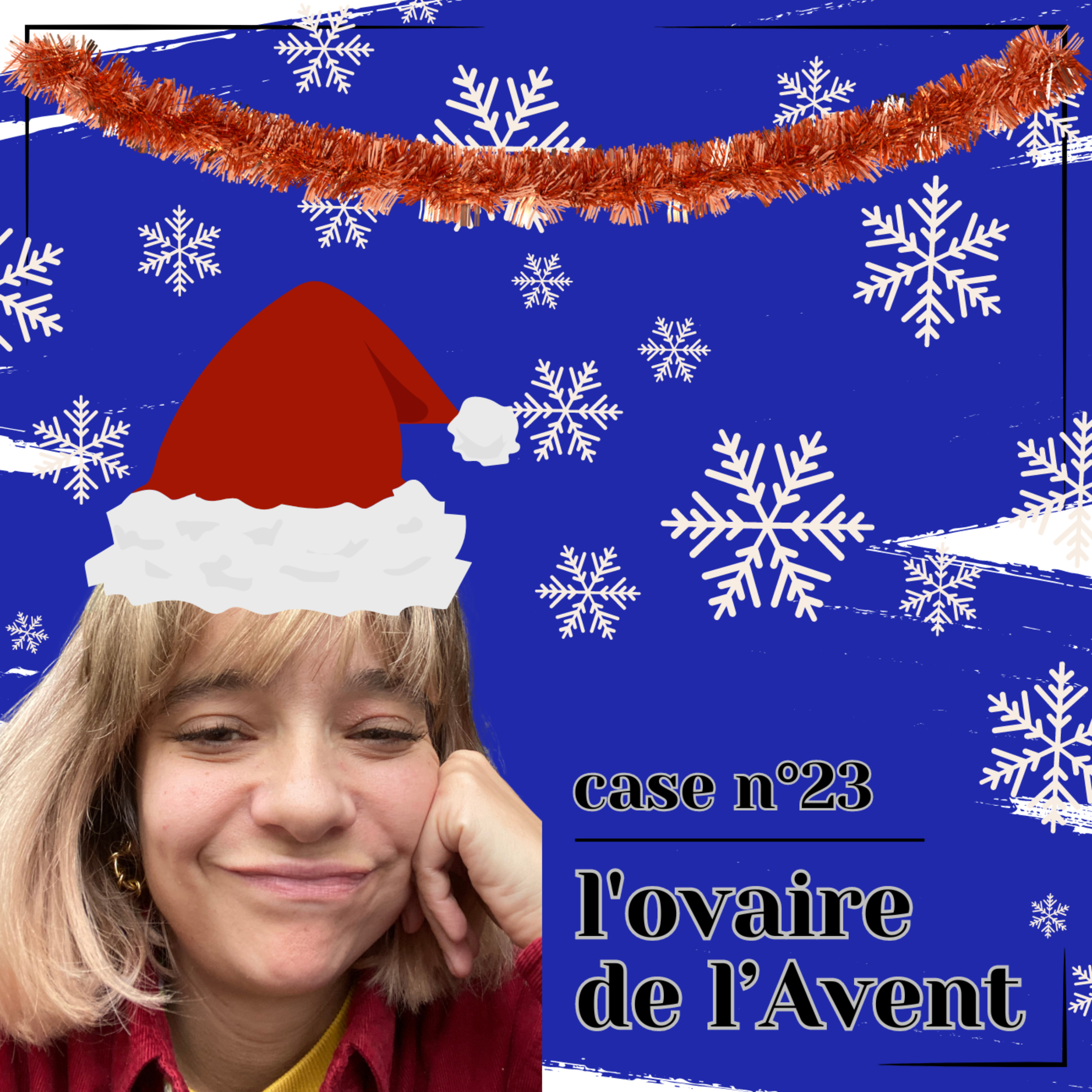 L\'ovaire du décor