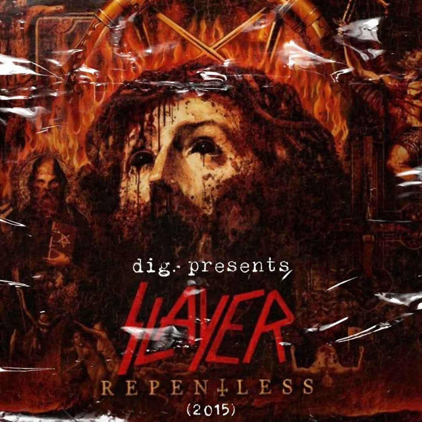 dig.