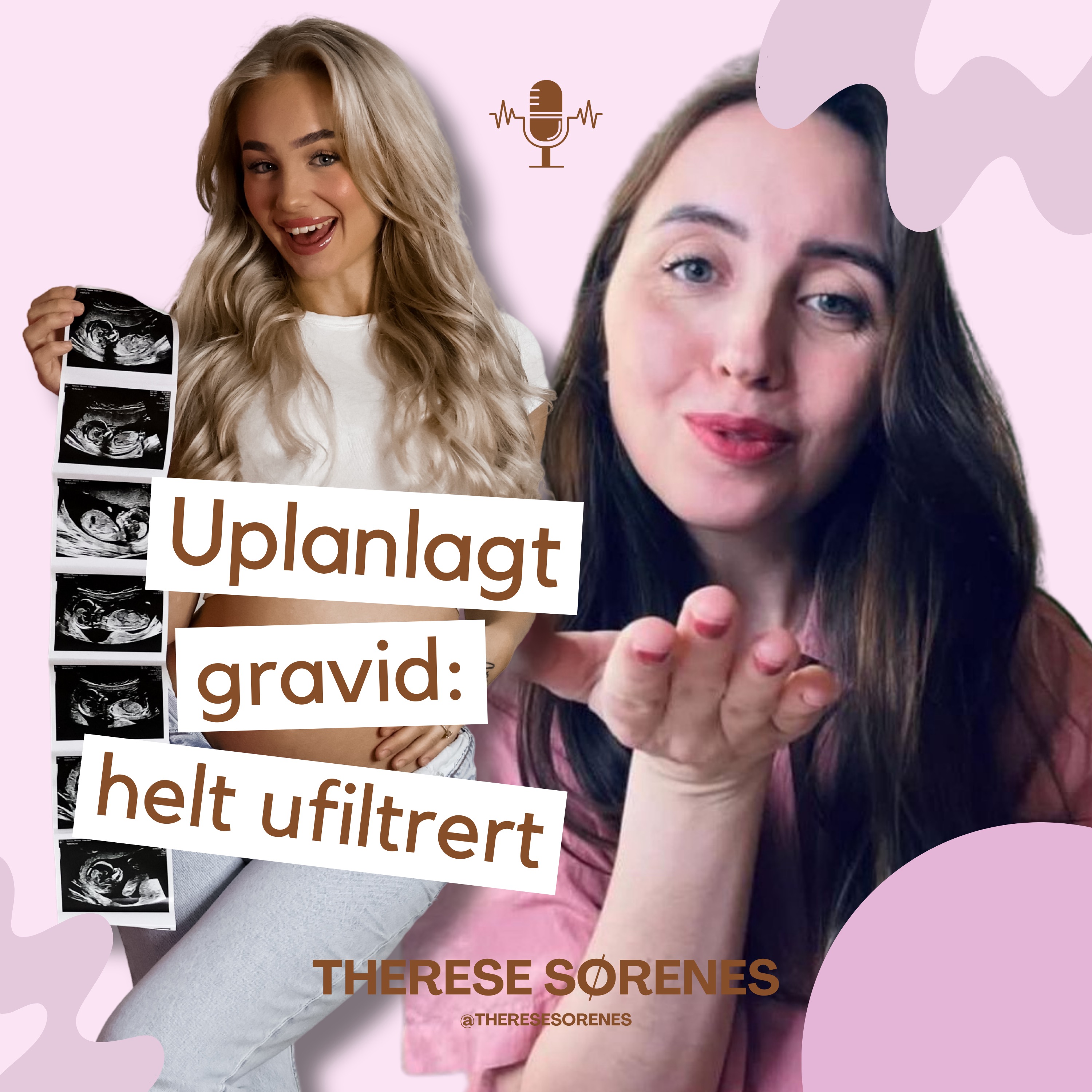 Uplanlagt gravid: helt ufiltrert