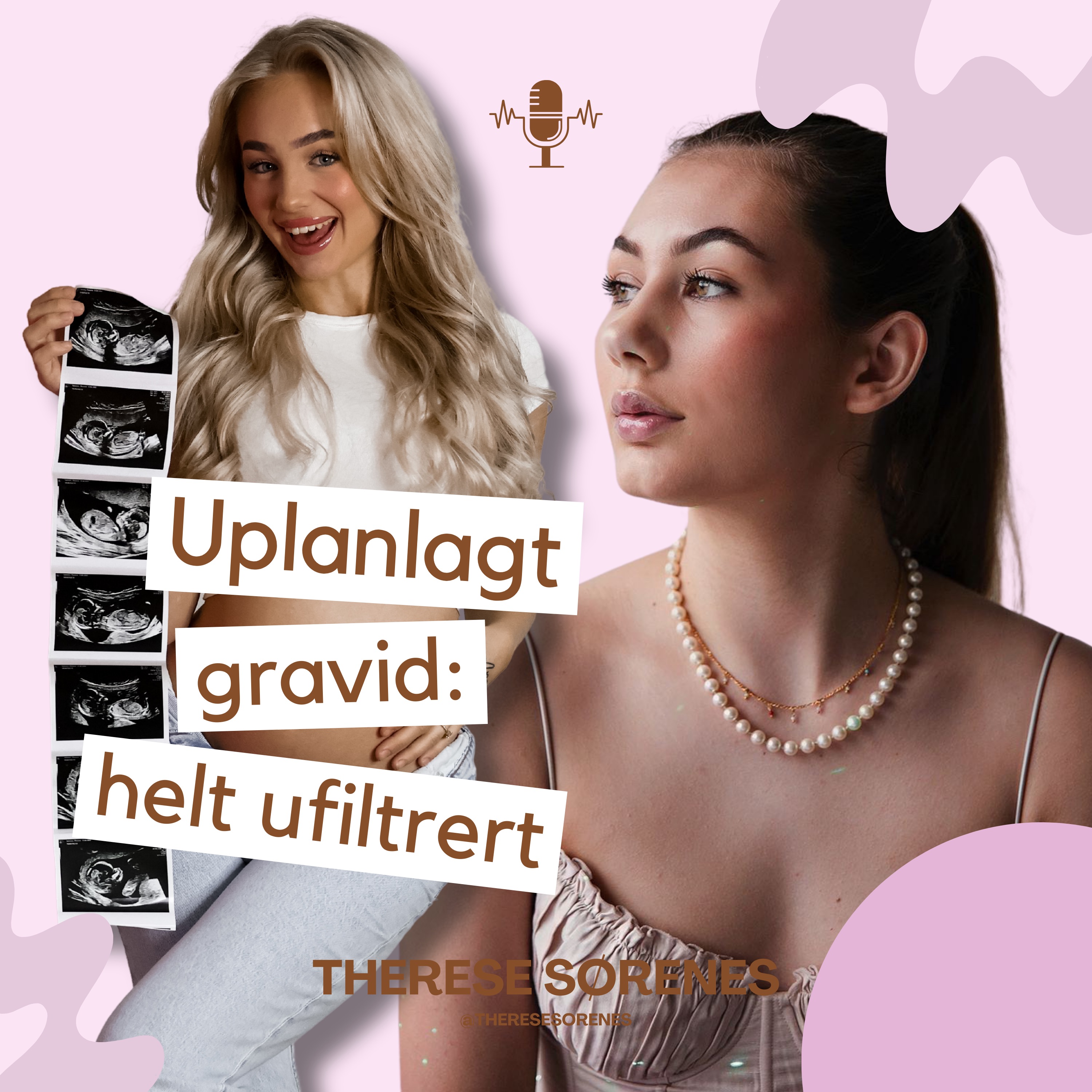 Uplanlagt gravid: helt ufiltrert
