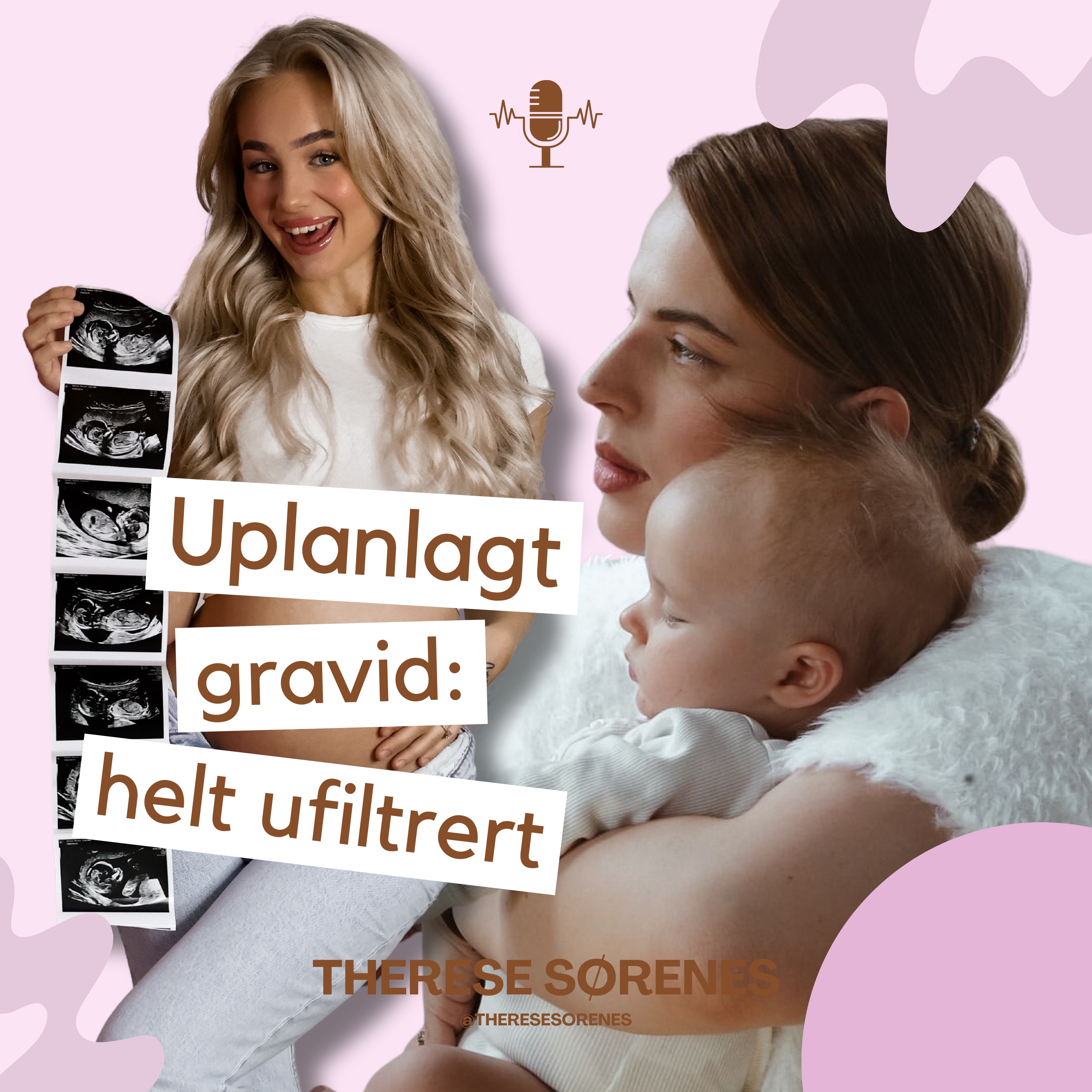 Uplanlagt gravid: helt ufiltrert
