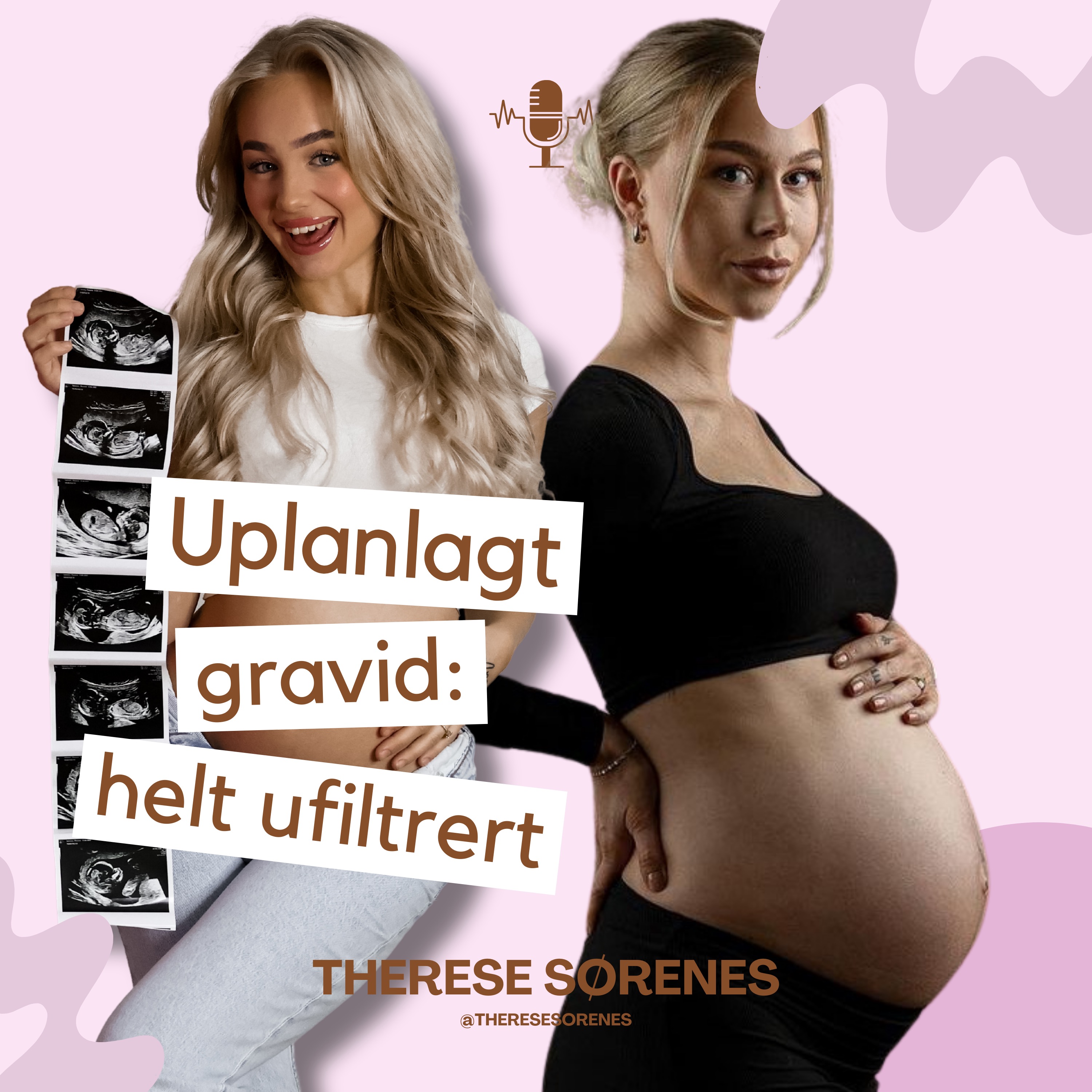 Uplanlagt gravid: helt ufiltrert