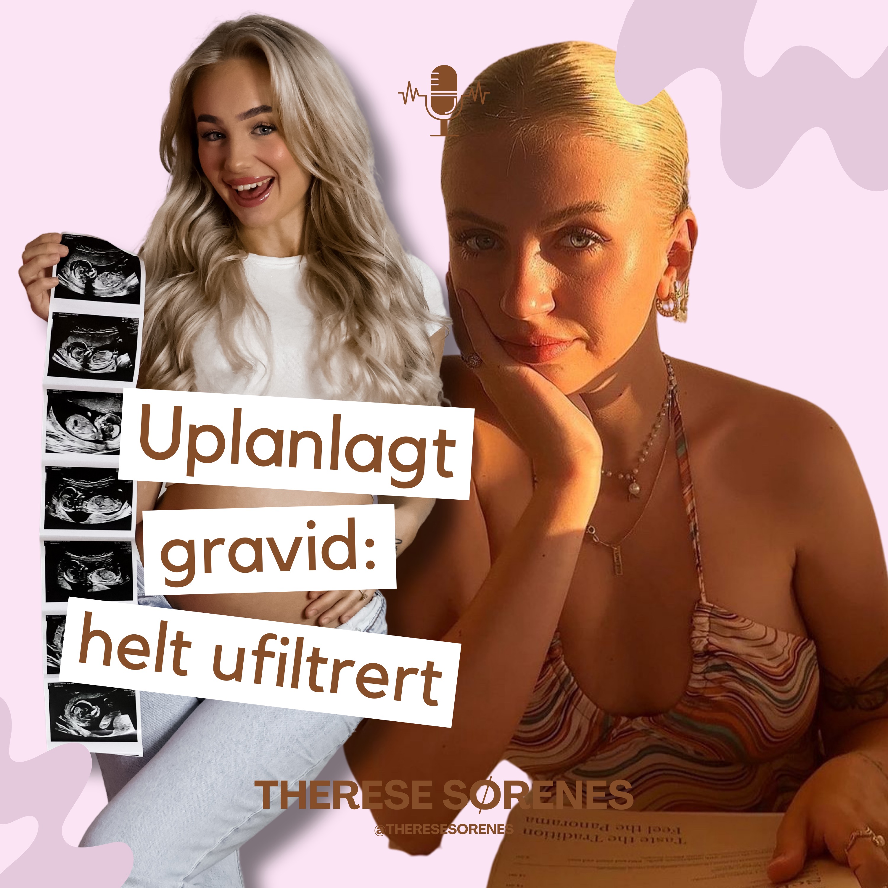 Uplanlagt gravid: helt ufiltrert