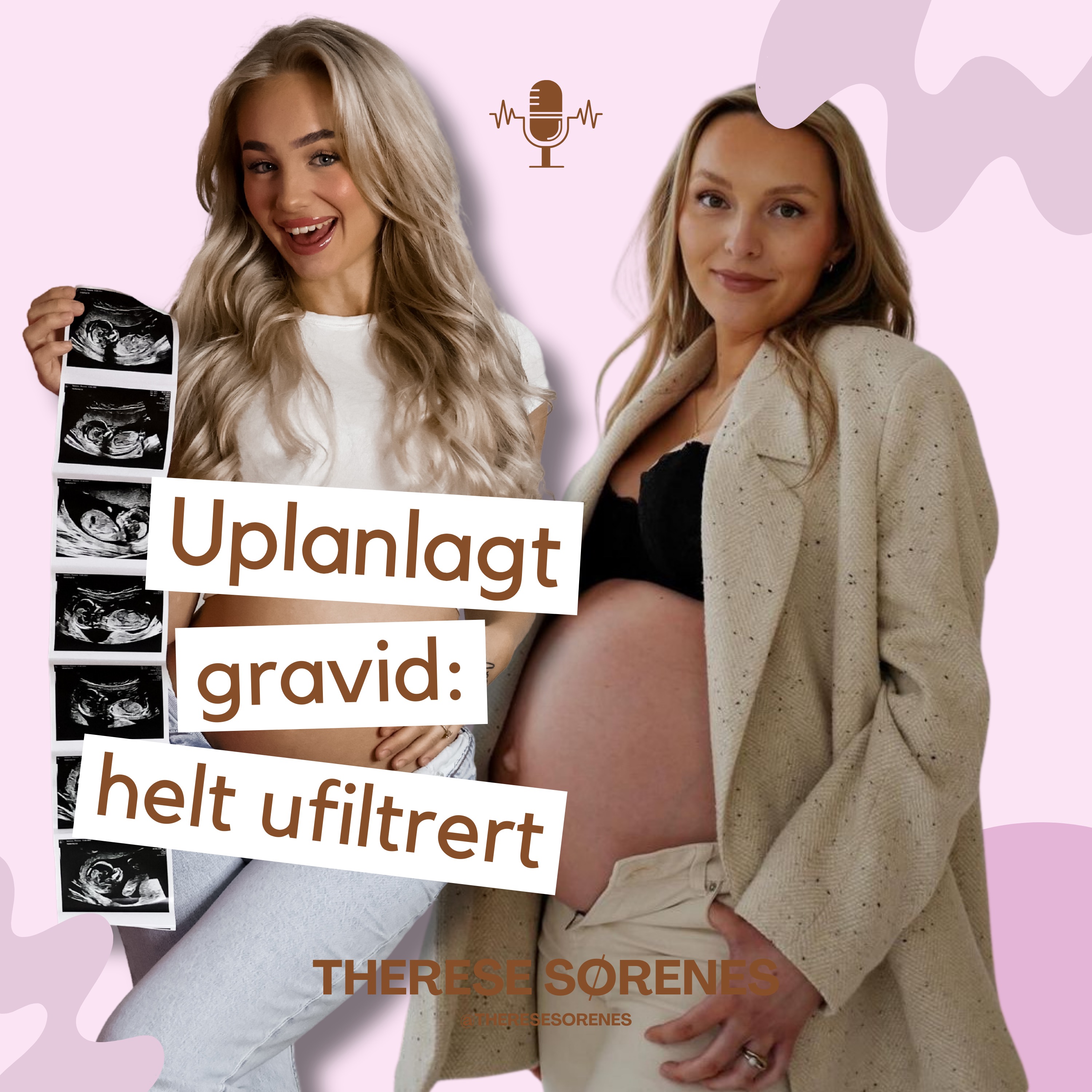 Uplanlagt gravid: helt ufiltrert