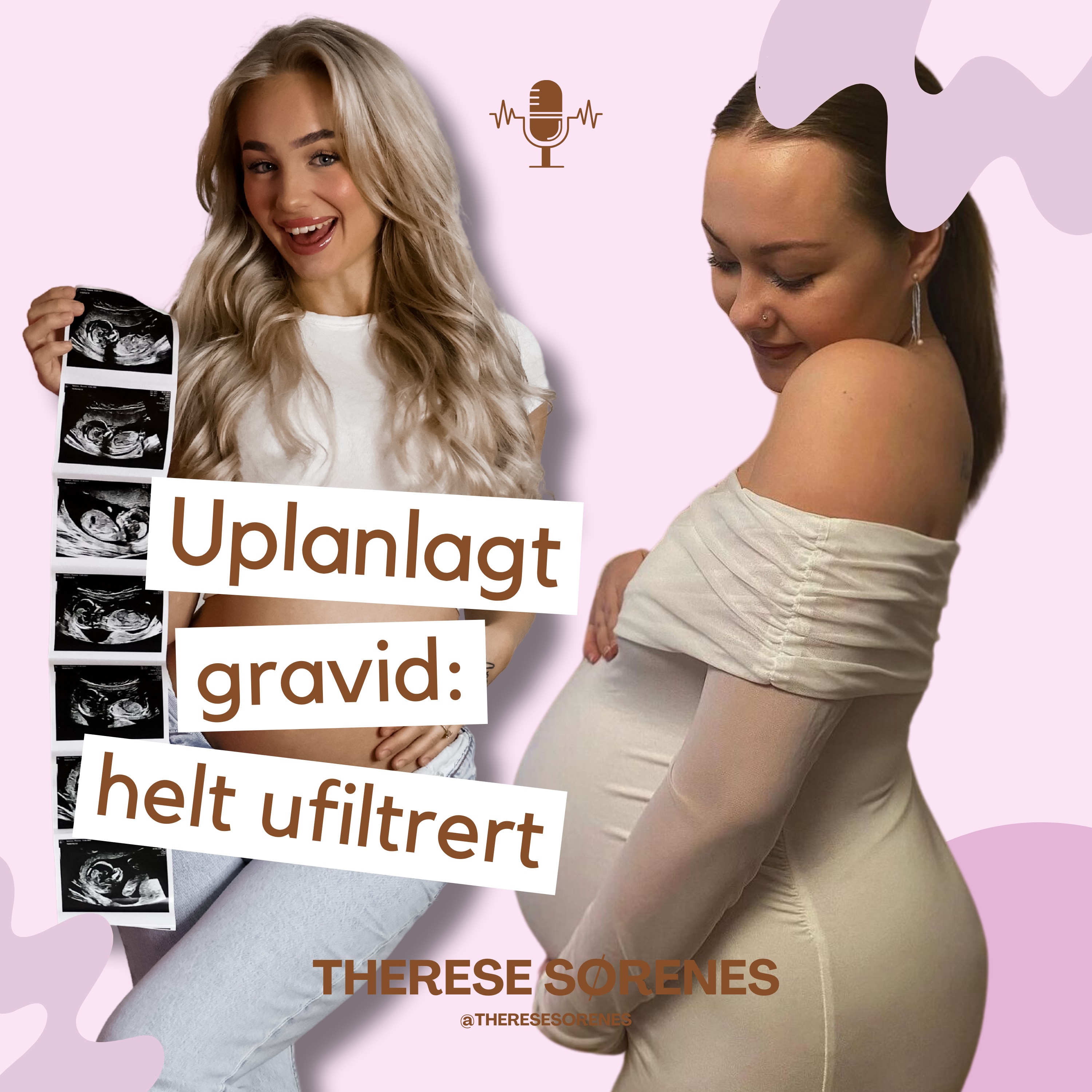 Uplanlagt gravid: helt ufiltrert