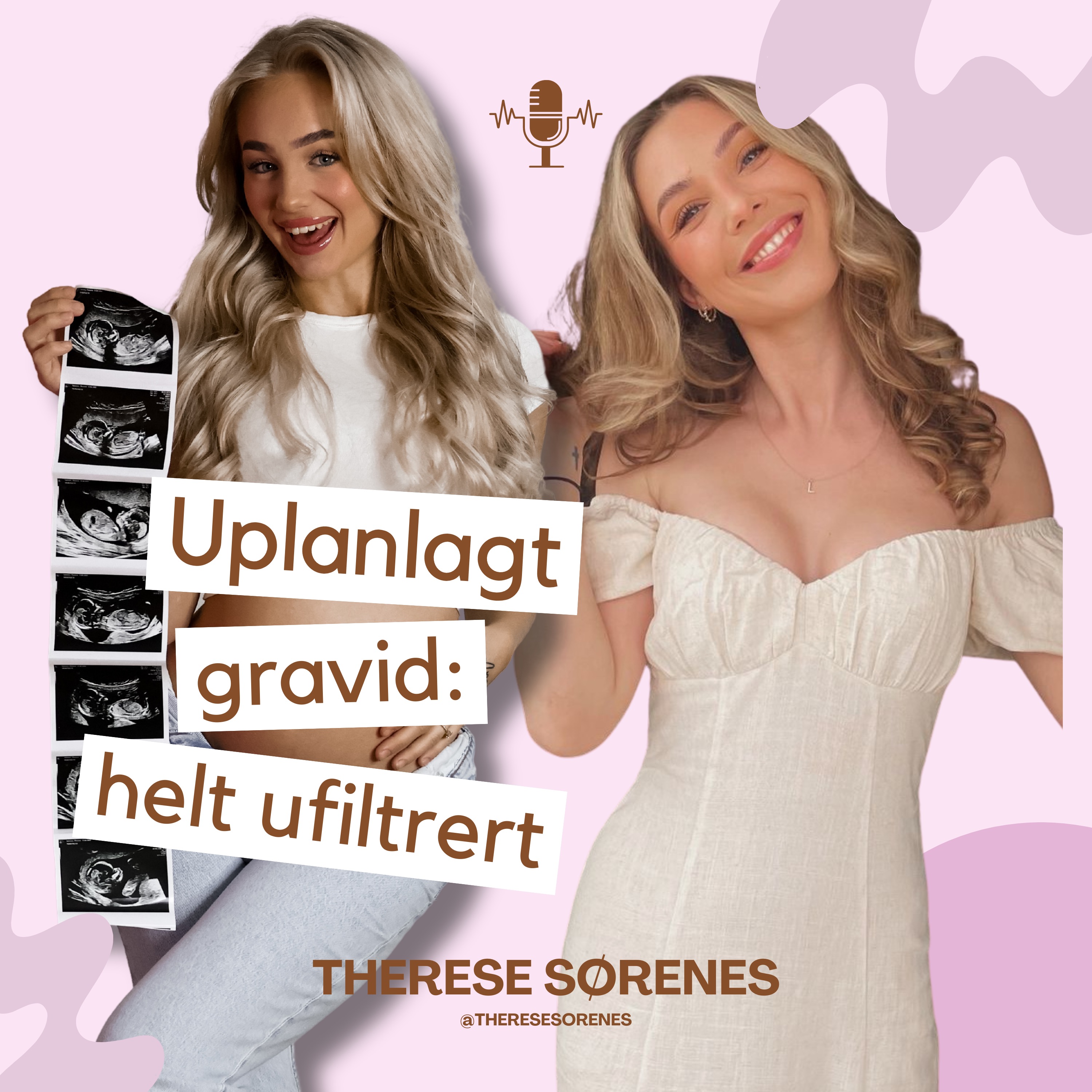 Uplanlagt gravid: helt ufiltrert