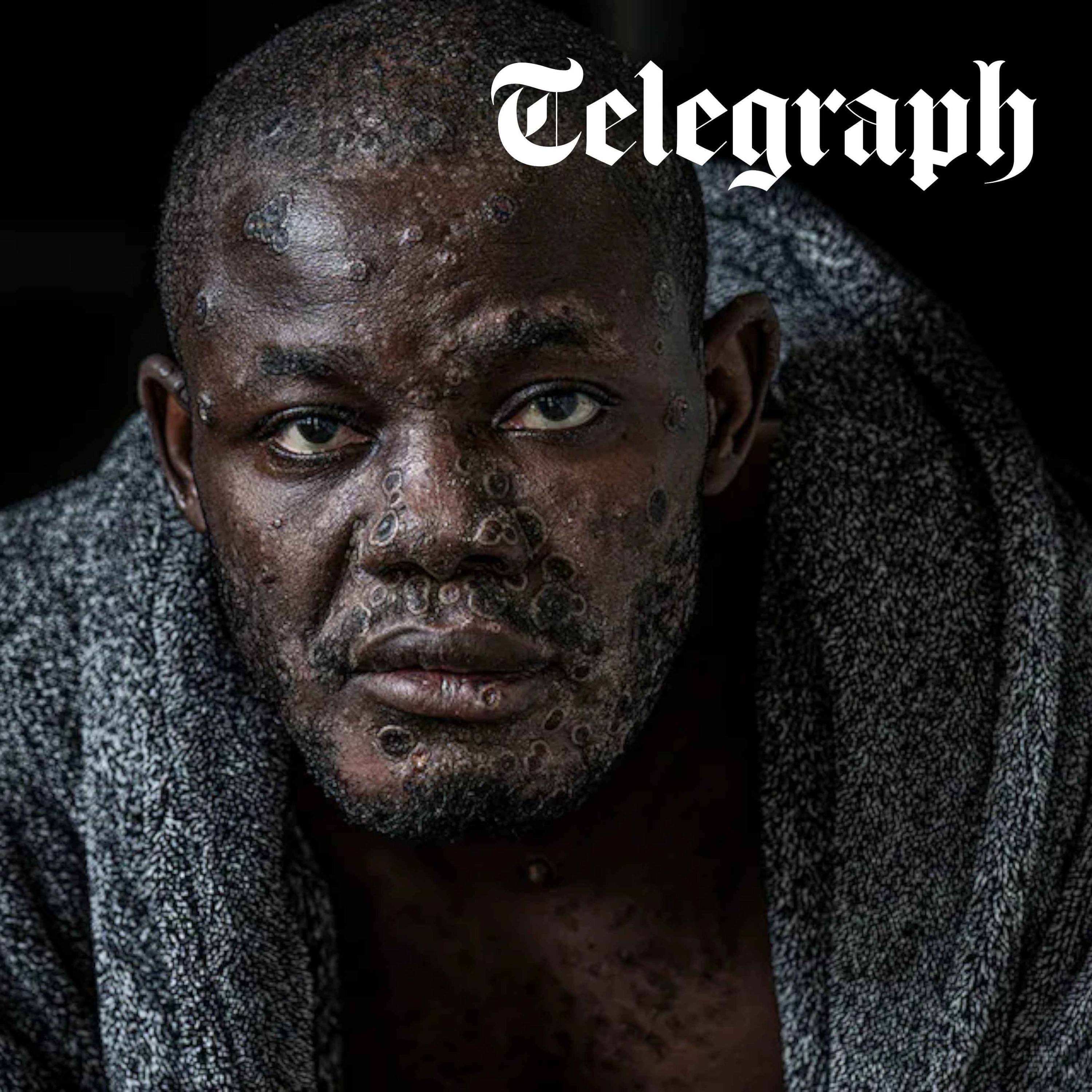 Photographing war, disease and nuclear accidents with Simon Townsley