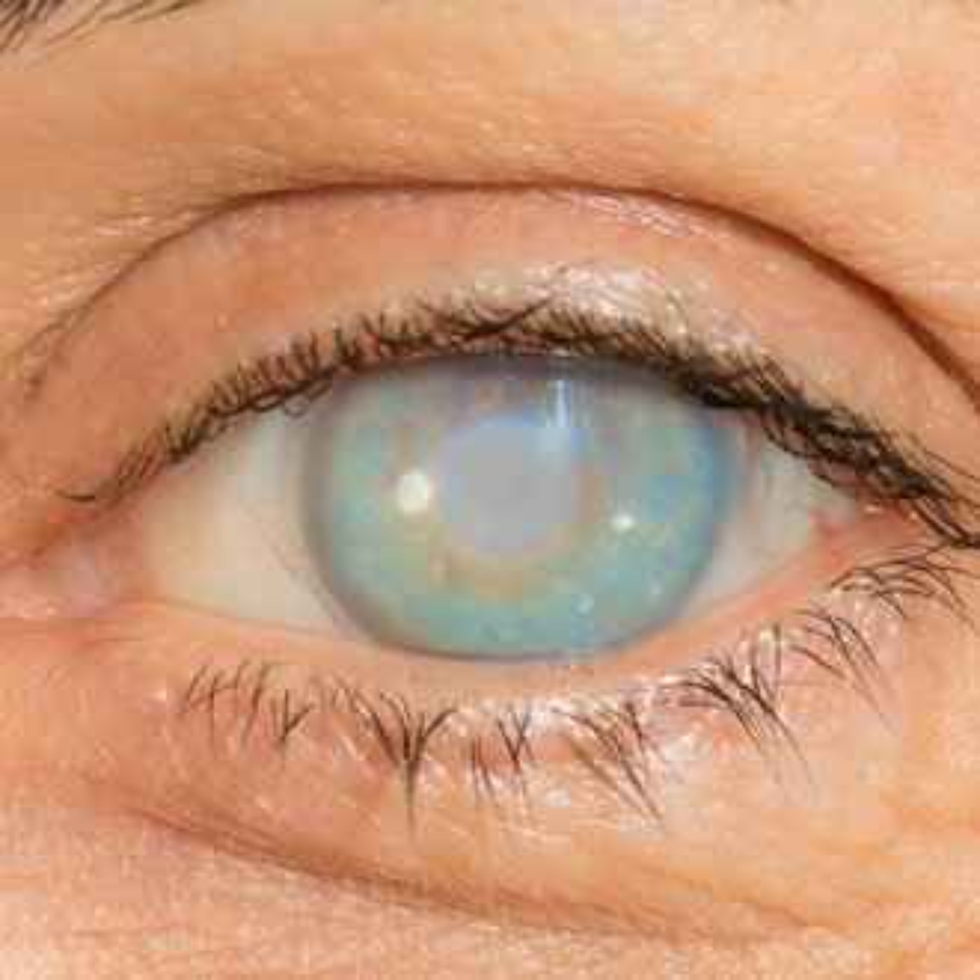 I'm Blind - What's Your Excuse?