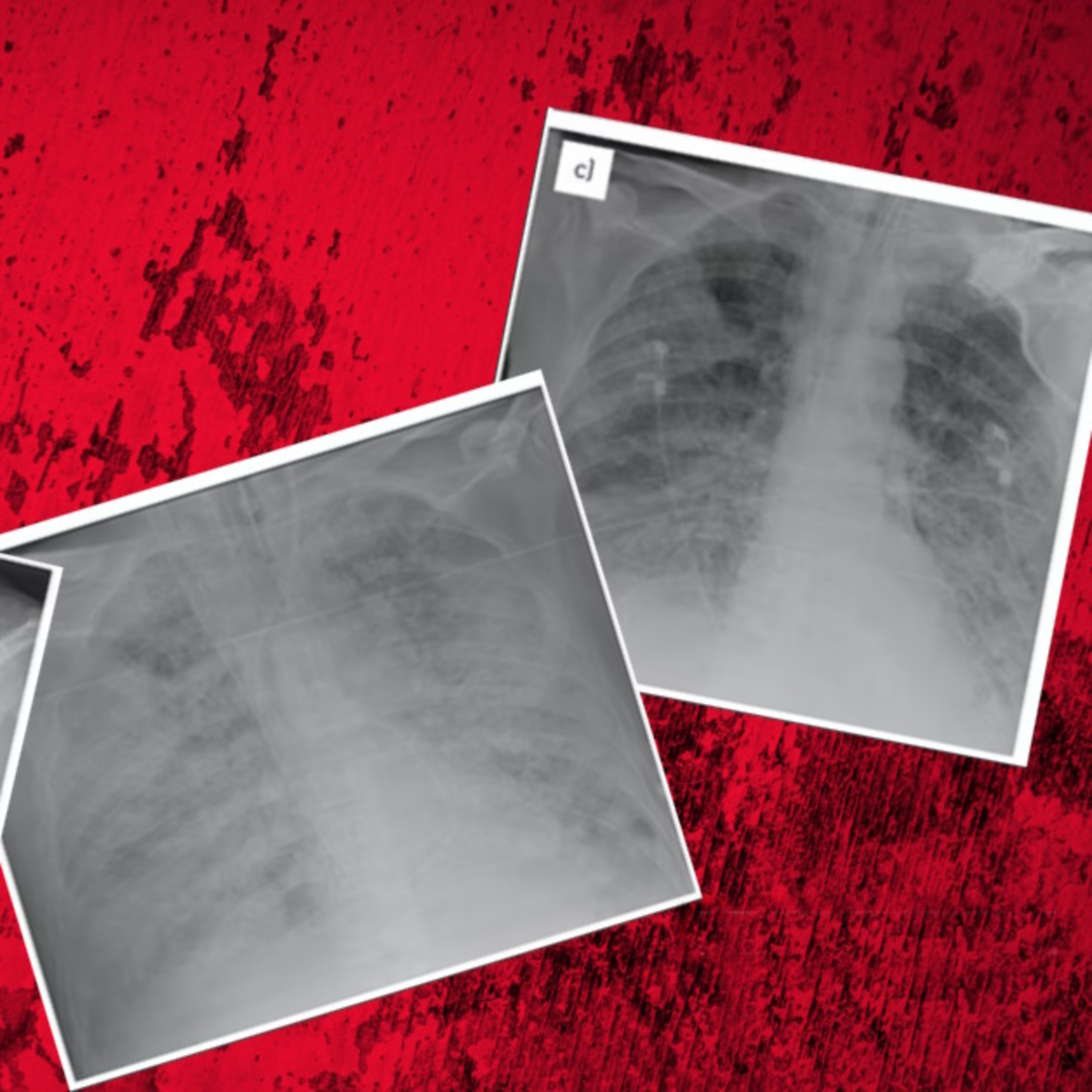 Dr. Lee Merritt: Exposing The Latest "Chinese White Lung" Narrative - Same Playbook As COVID