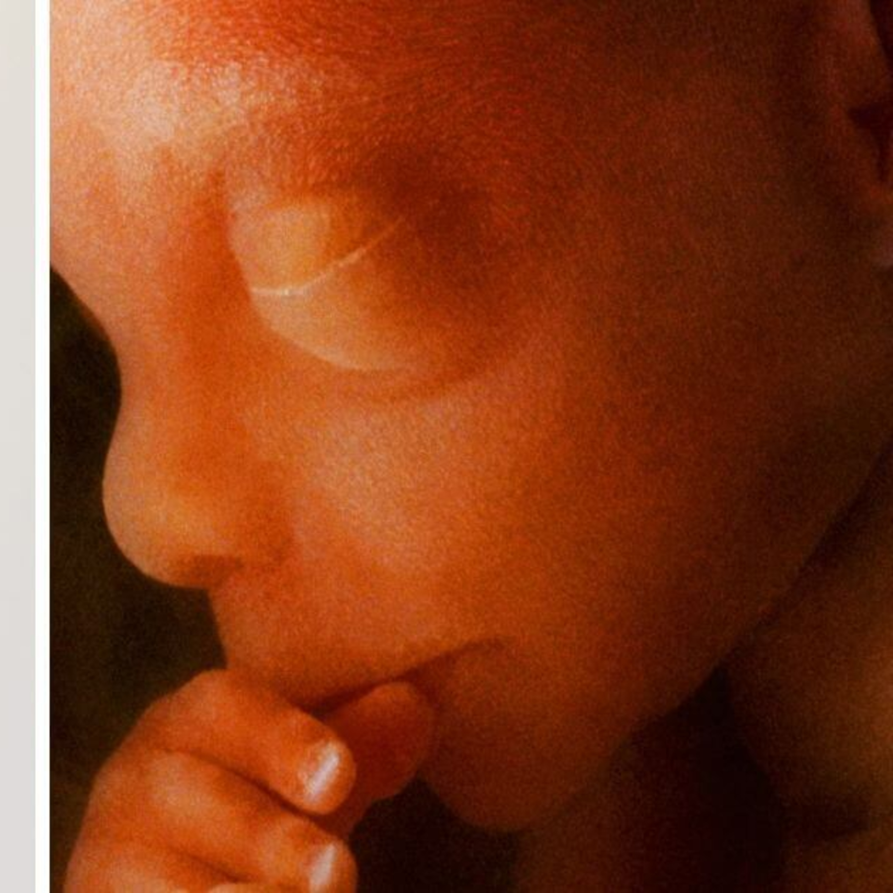 Abominable 40-Week, Sex Selection Abortions Pushed By Muslim Plus Reversing Health Problems With Kate Shemirani