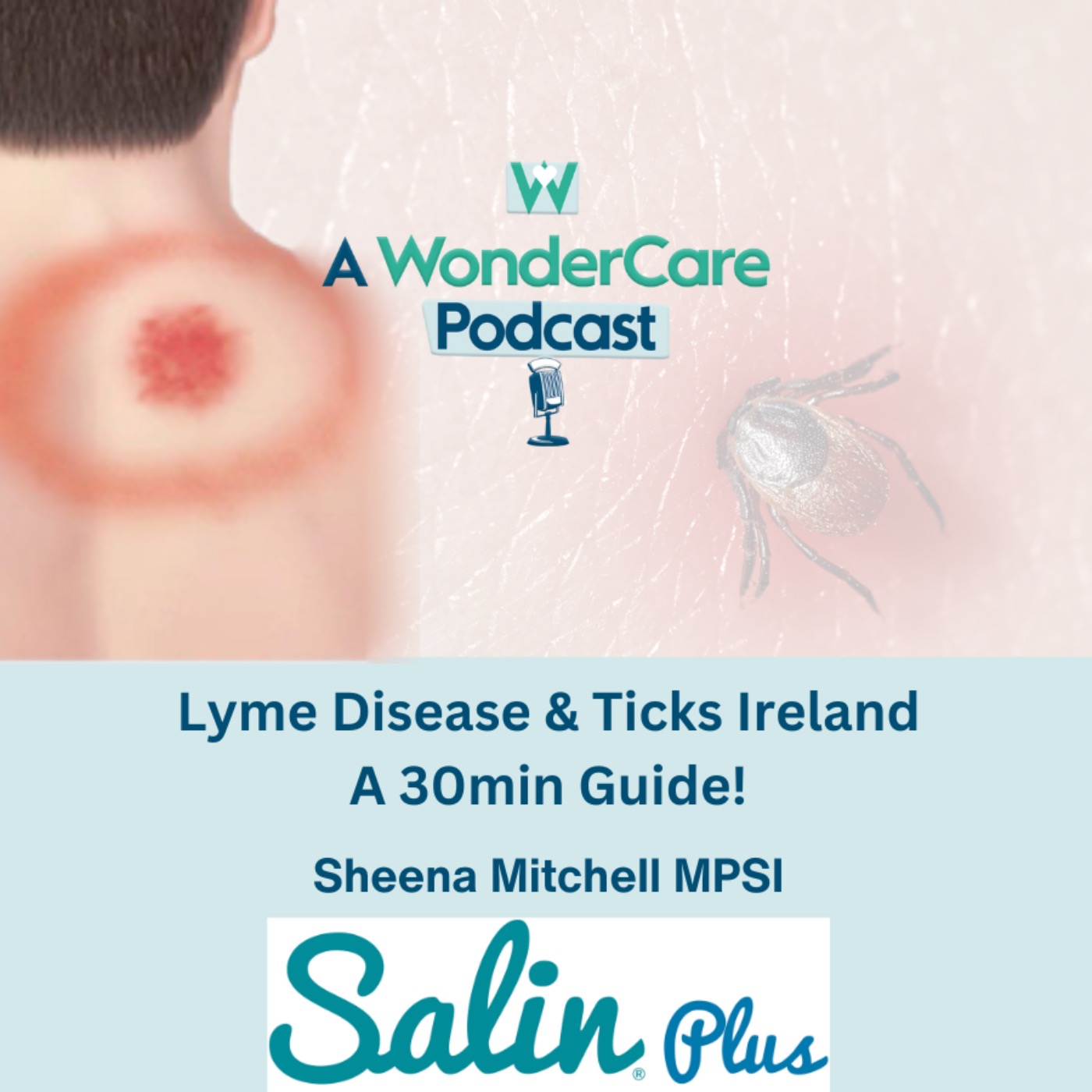 Lyme Disease and Ticks Ireland