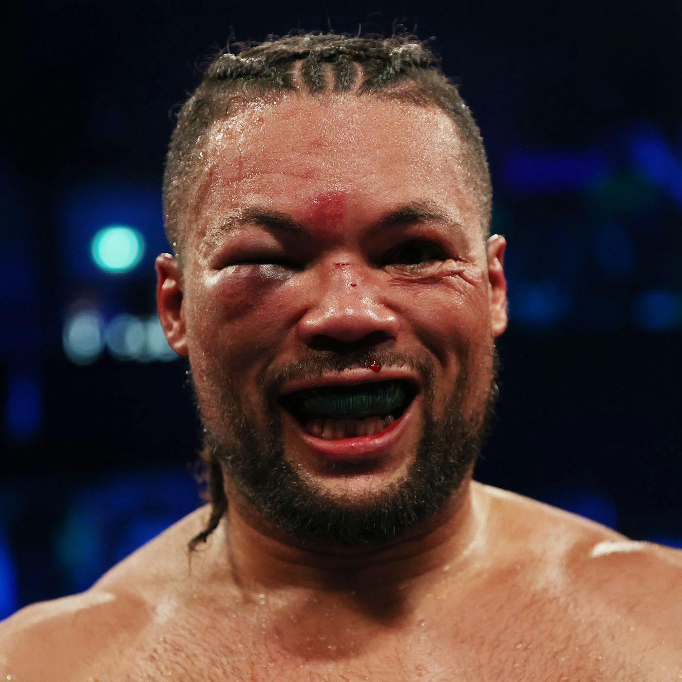 711: BOXING REVIEW: ROTTEN EYE JOE