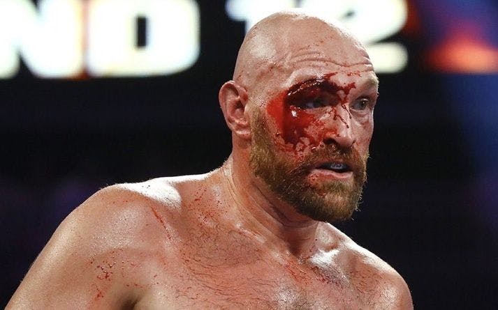 327: Winners find a way to win