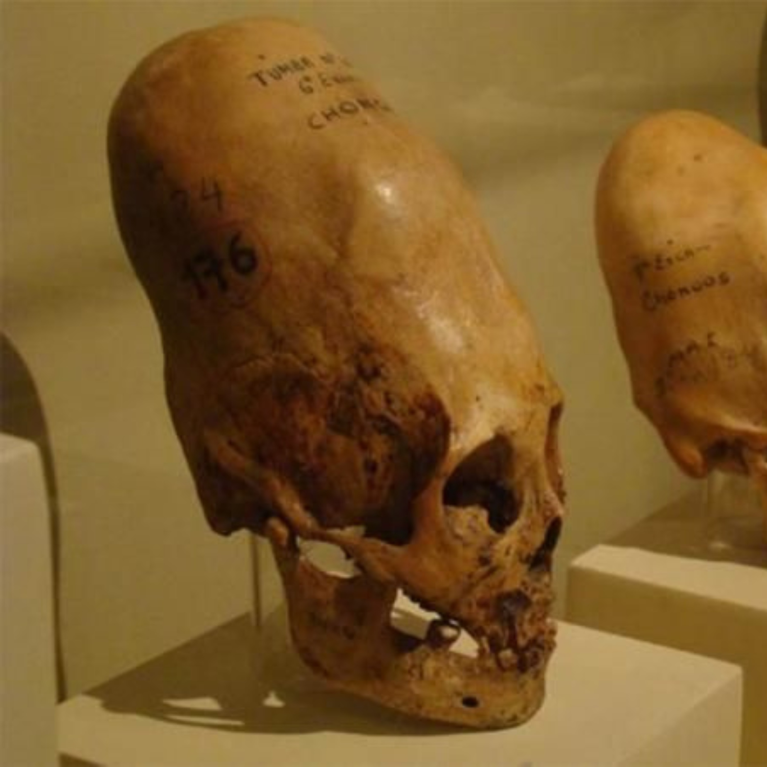 Elongated Skulls: Human or Alien?