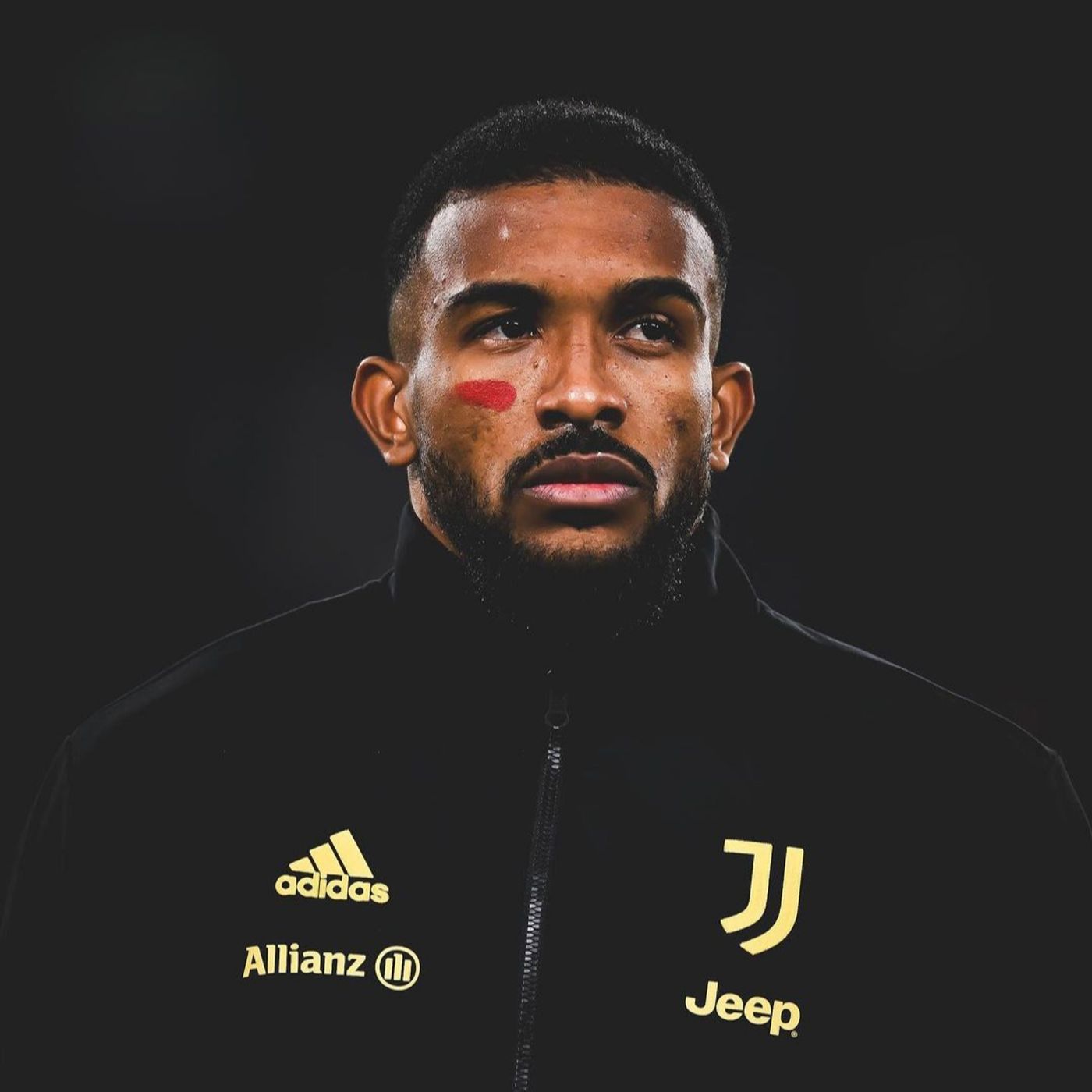 La solidità della Juve episode artwork